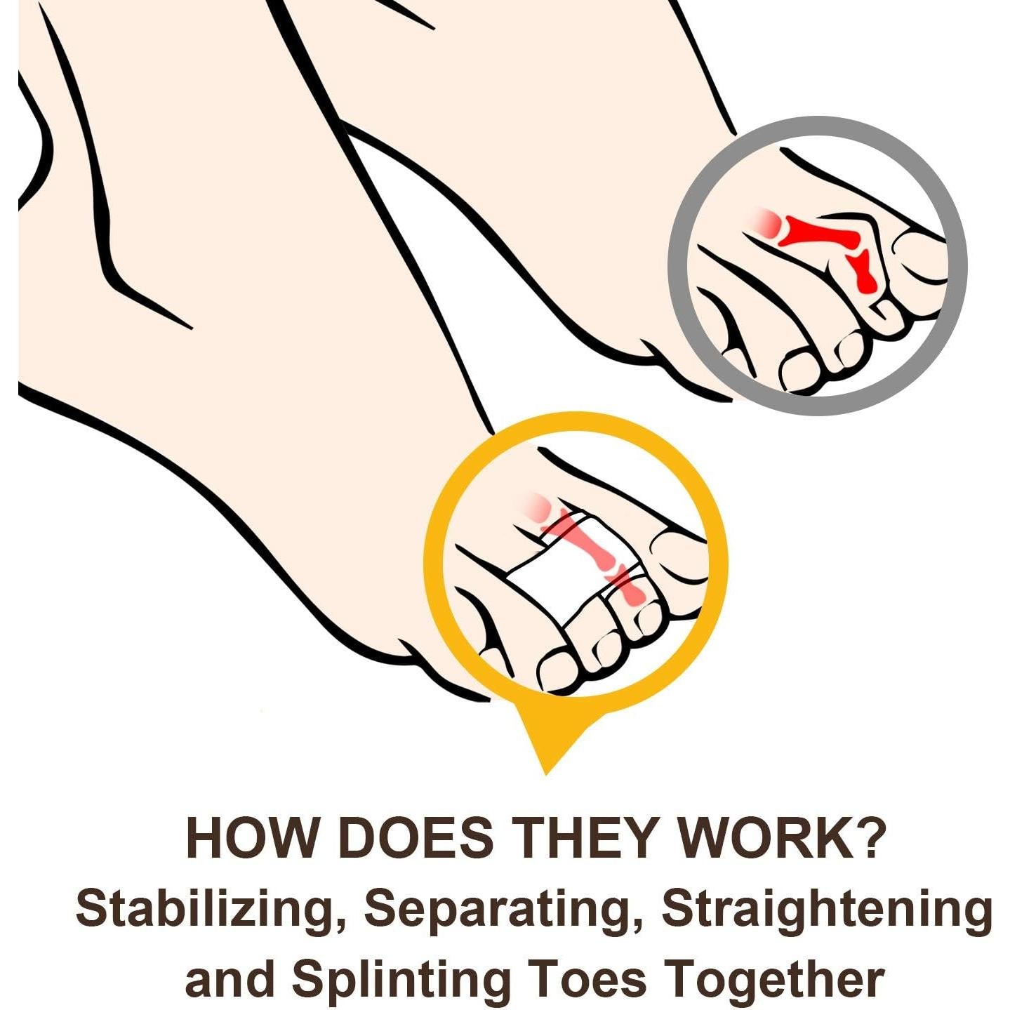 Welnove 6 Piezas Corrector de Dedo en Martillo y Vendajes