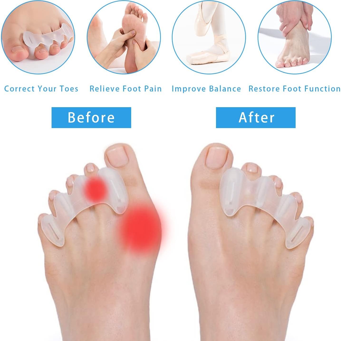 Separador de Dedos COOLWAVE Ajustable para Juanetes y Fascitis