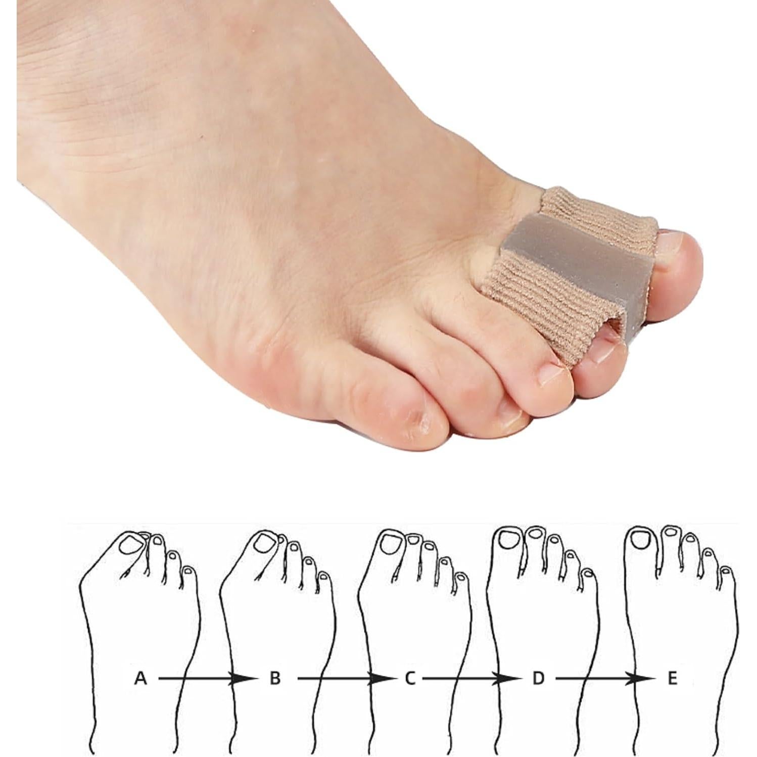 Separador de Dedos JHTSOLE Corrector de Juanetes S+L