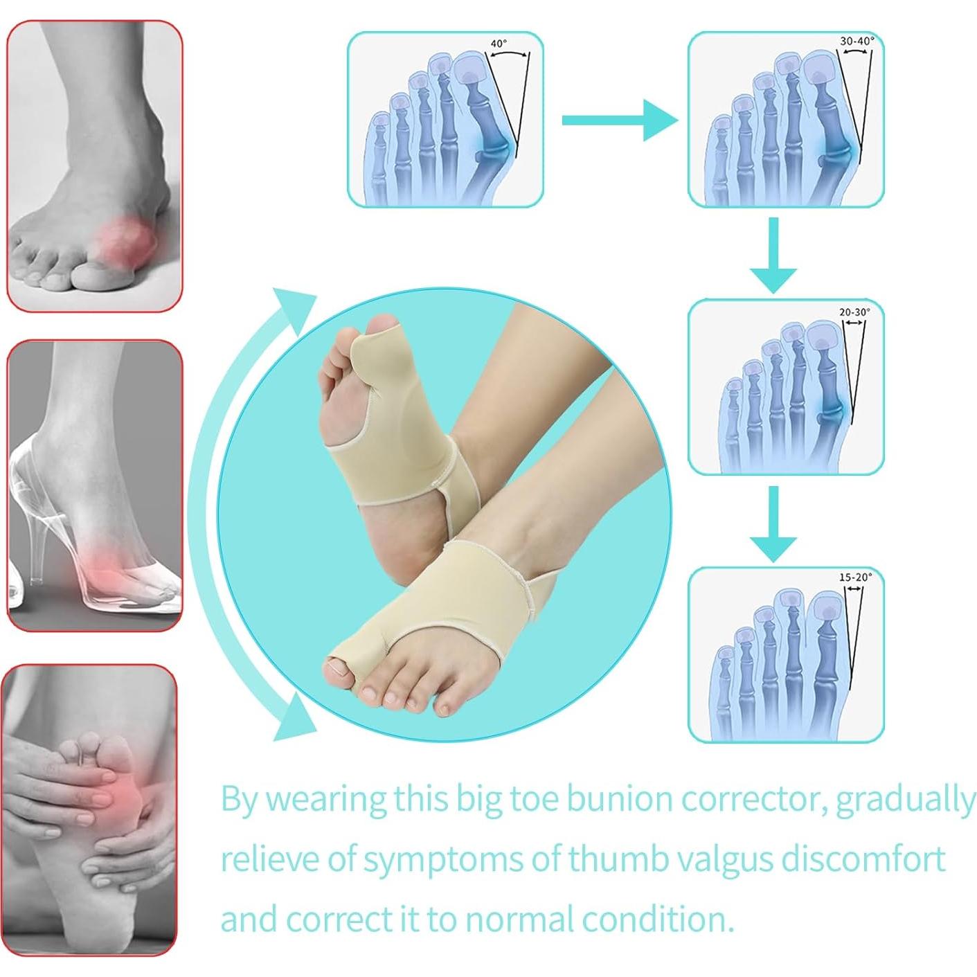 Mangas Correctoras de Juanetes Shengchuang - Grande