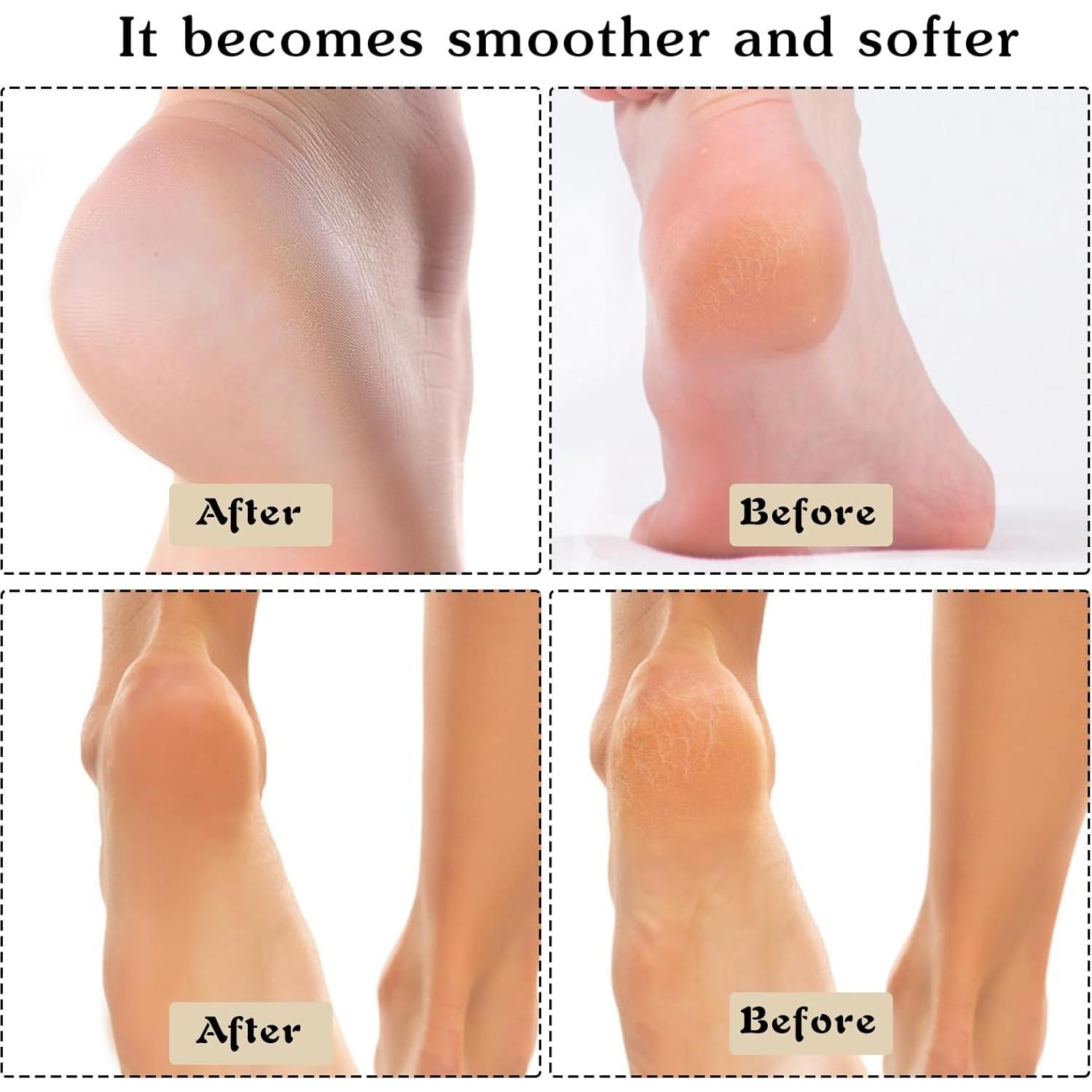 4 Pares de Calcetines Hidratantes para Talones DIVINA VITAE