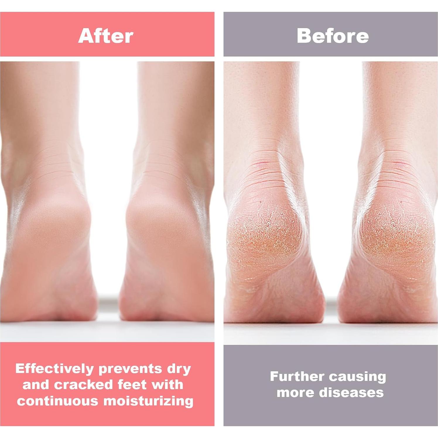 6 Pares de Calcetines Hidratantes de Silicona Vodolo para Pies