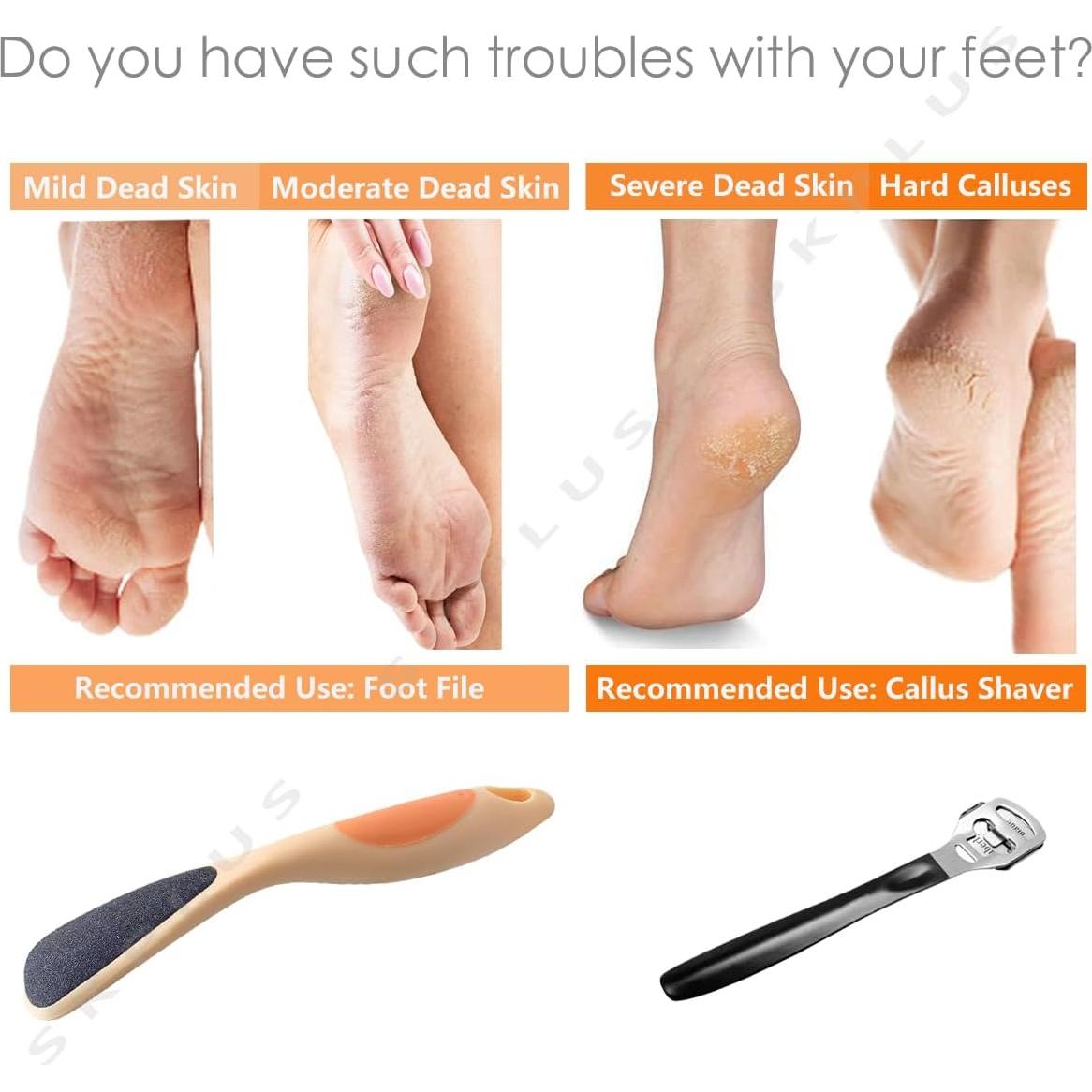 Lima de Pies Pumice Valley - Removedor de Callos 31 Cuchillas