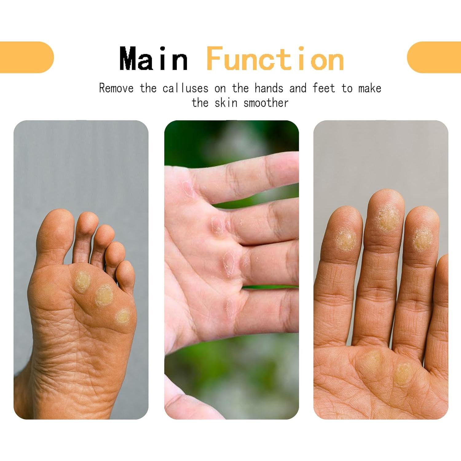 Removedor de Callos JLDGMXCDZ con 3 Papeles de Lija 100/180/400
