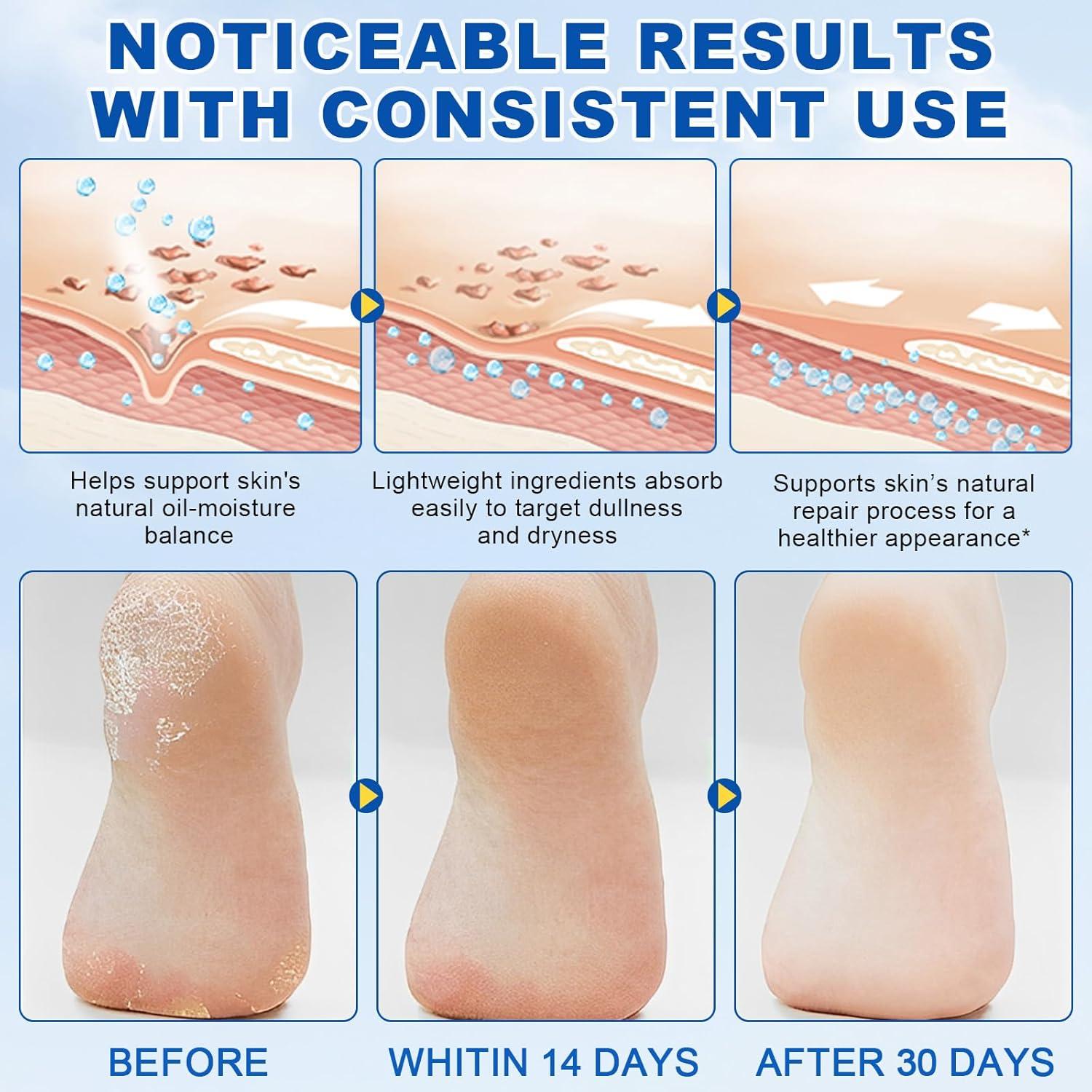 Crema en Barra 60% Urea + 2% Ácido Salicílico para Pies