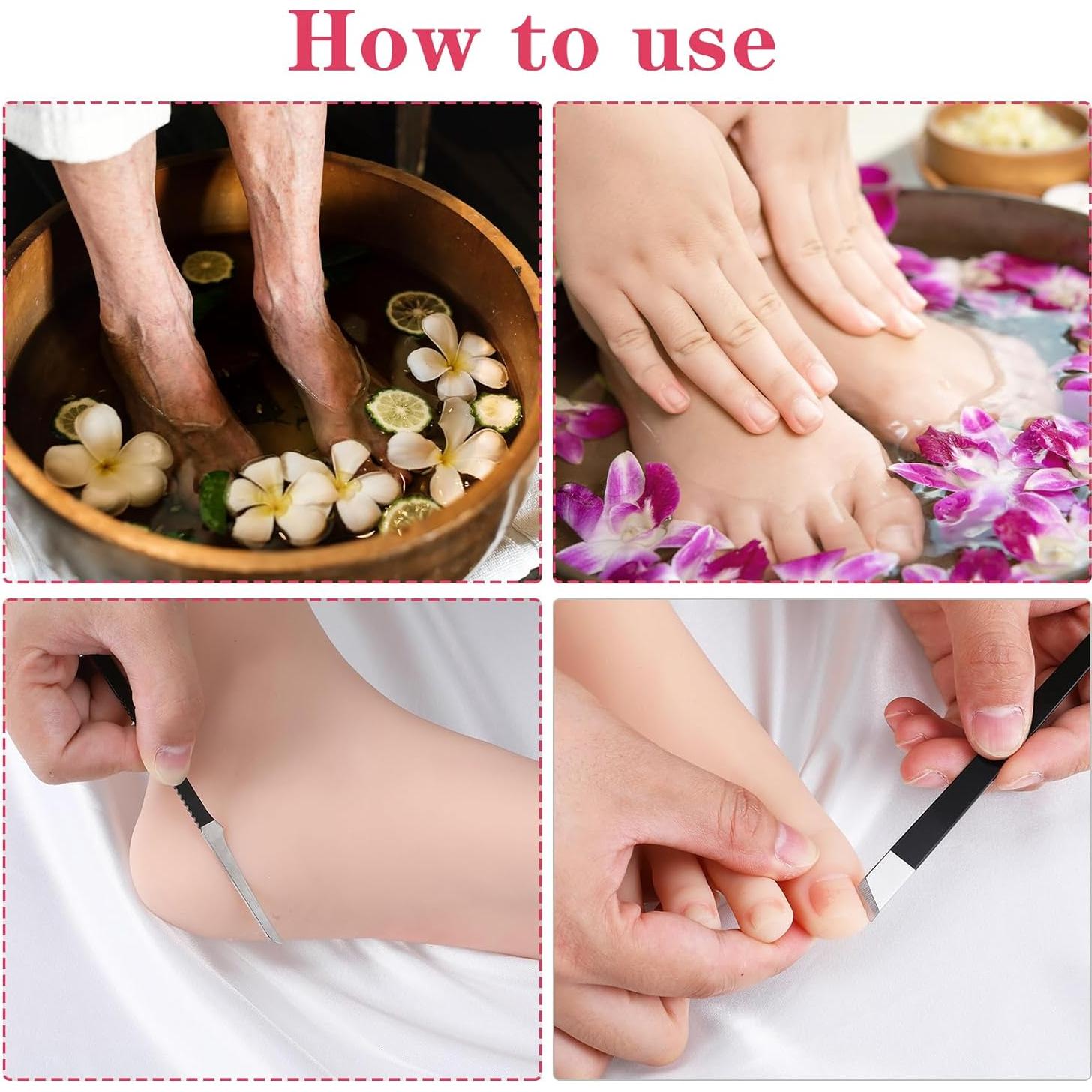 Kit de Remoción de Uñas Encarnadas MBAIYO 6 Piezas Acero Inoxidable