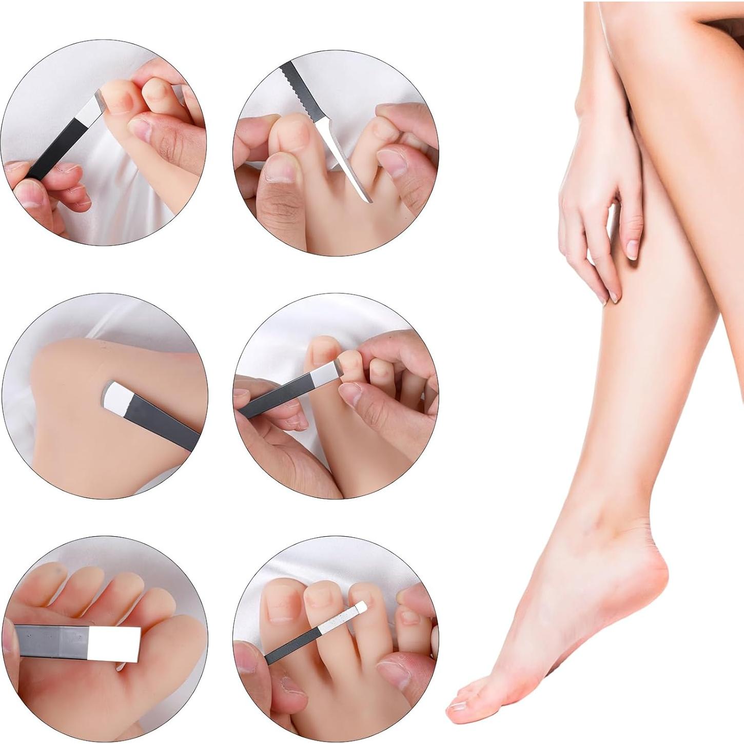 Kit de Remoción de Uñas Encarnadas MBAIYO 6 Piezas Acero Inoxidable