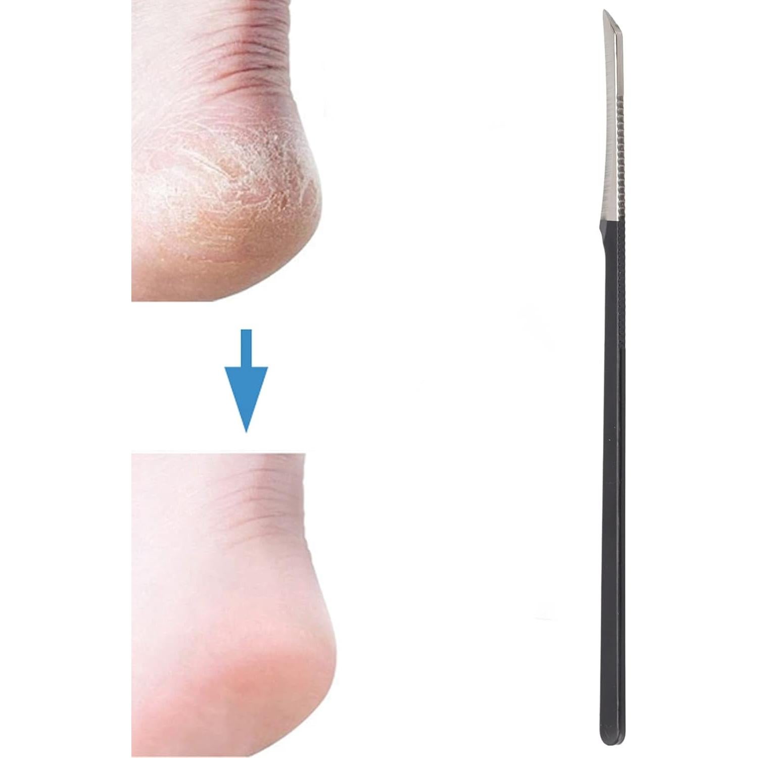 Raspador de Piel Muerta Yosoo para Pedicura, Acero Inoxidable