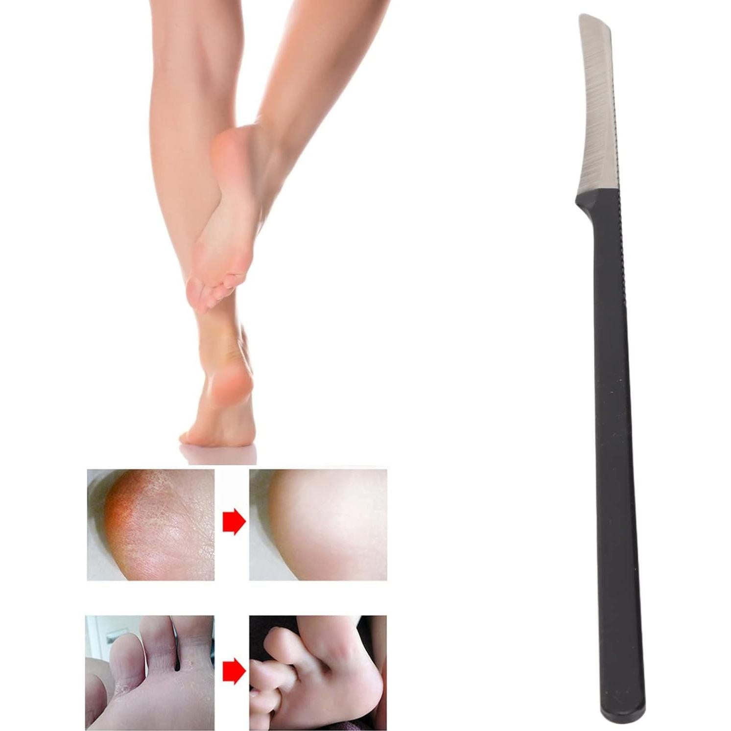 Raspador de Piel Muerta Yosoo para Pedicura, Acero Inoxidable