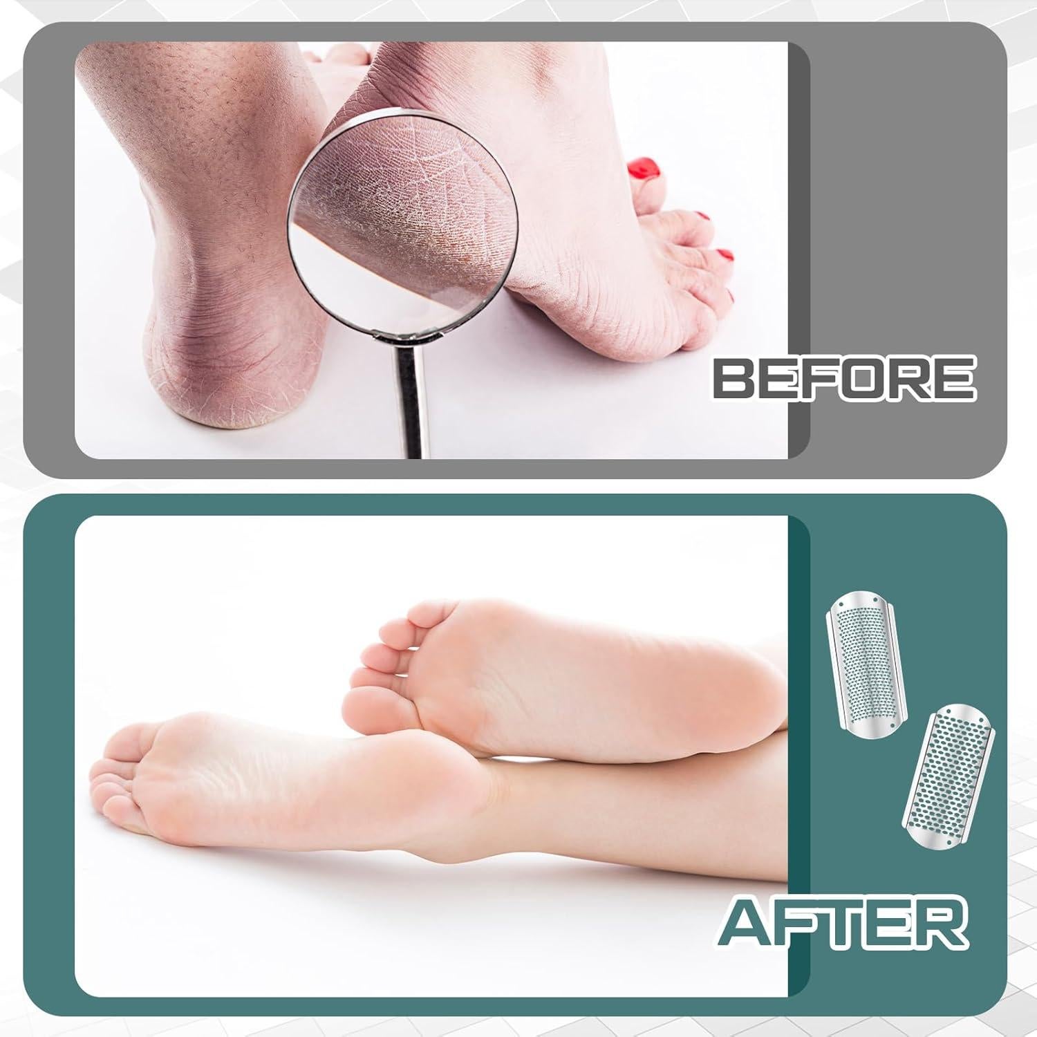 Lima para Pies Moxweyeni 8 Pcs Acero Inoxidable Removedor Callos