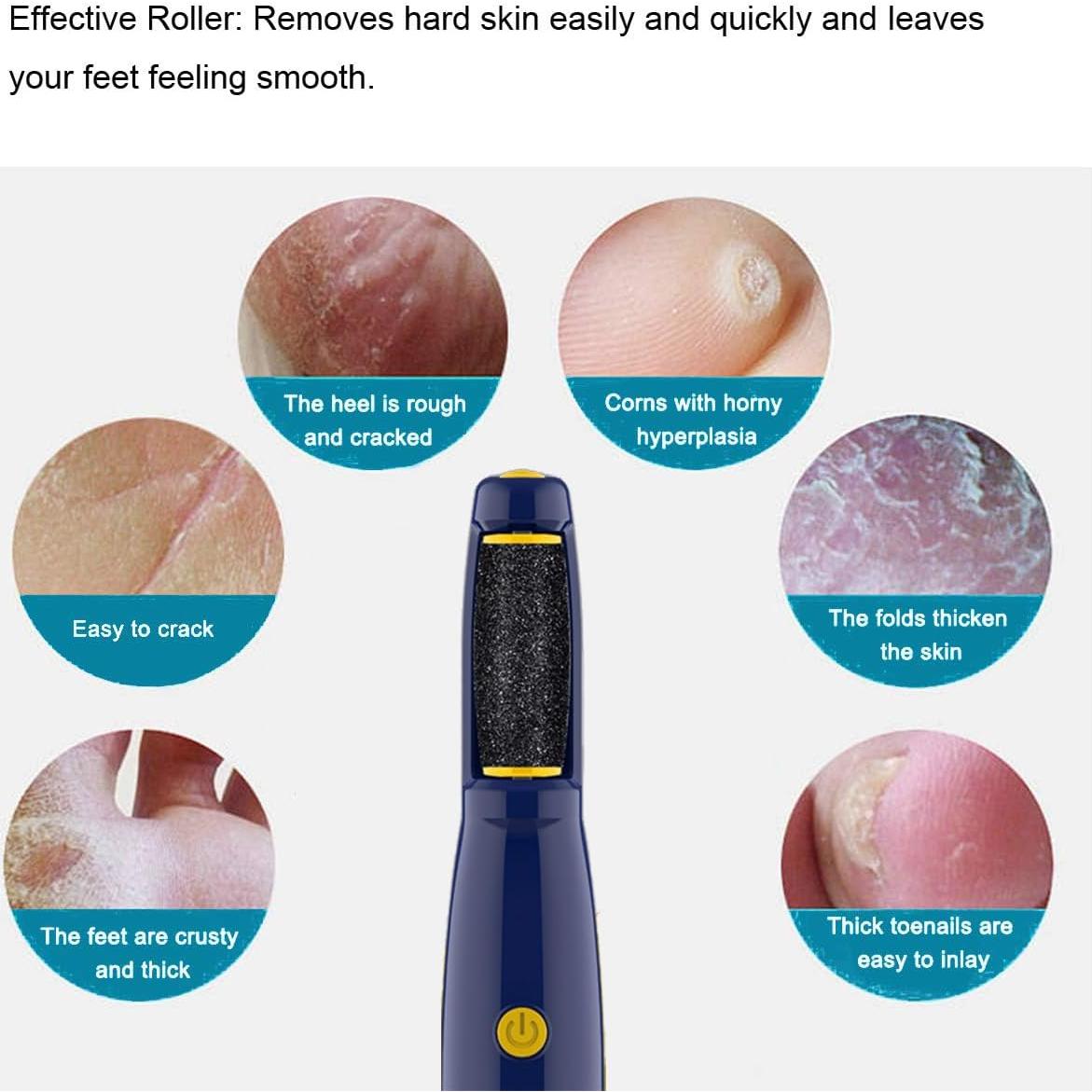 Rodillos de Reemplazo Extra Gruesos Dr. Scholl - 6 Paquete