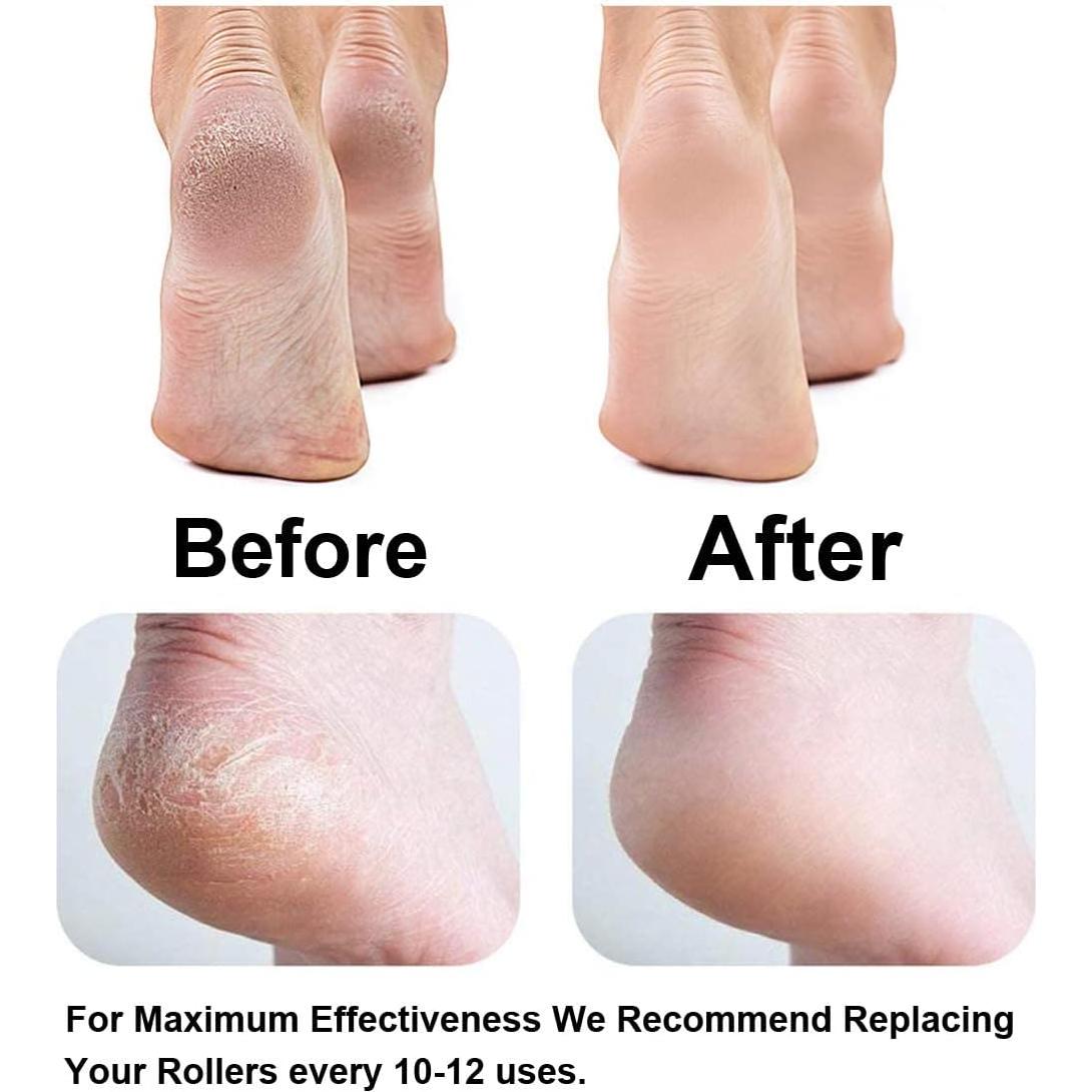 Rodillos de Reemplazo Extra Gruesos Dr. Scholl - 6 Paquete