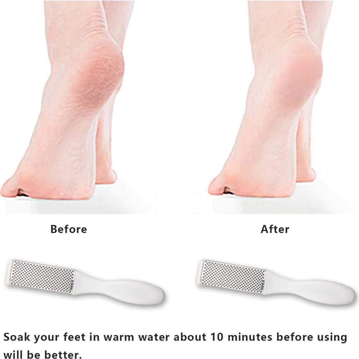 Removedor de Callos Profesional Quanzhou - Exfoliador de Pies Acero Inoxidable