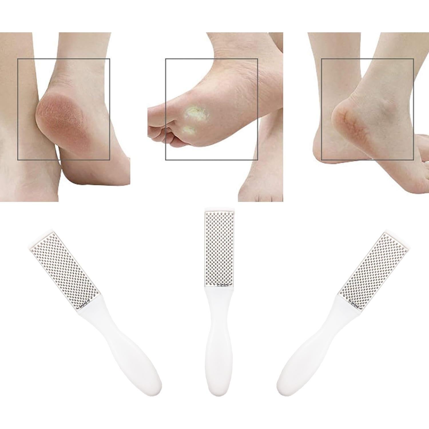 Removedor de Callos Profesional Quanzhou - Exfoliador de Pies Acero Inoxidable