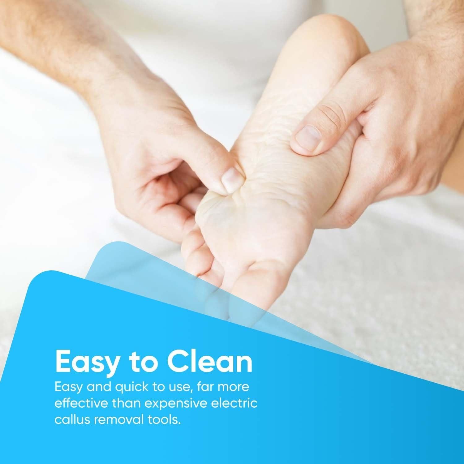 Raspador de Pies YNR de Acero Inoxidable para Callos y Durezas