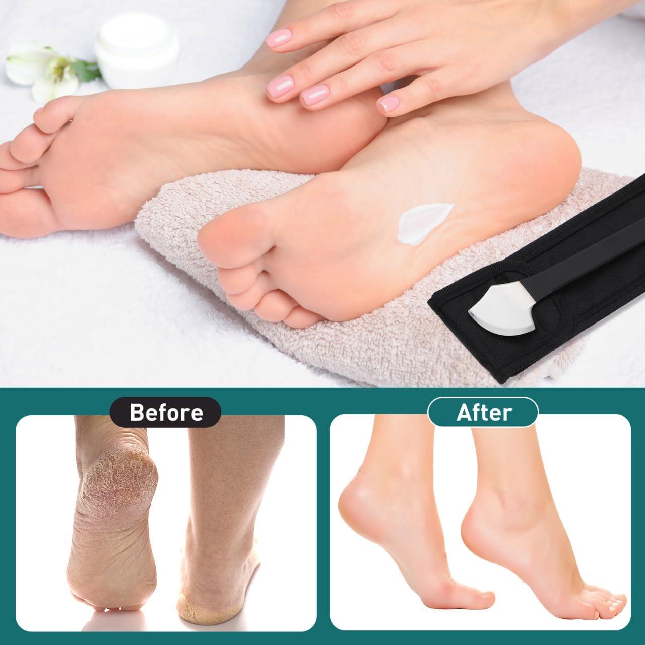 Kit de Pedicura Healifty - Removedor de Callos y Lima de Uñas