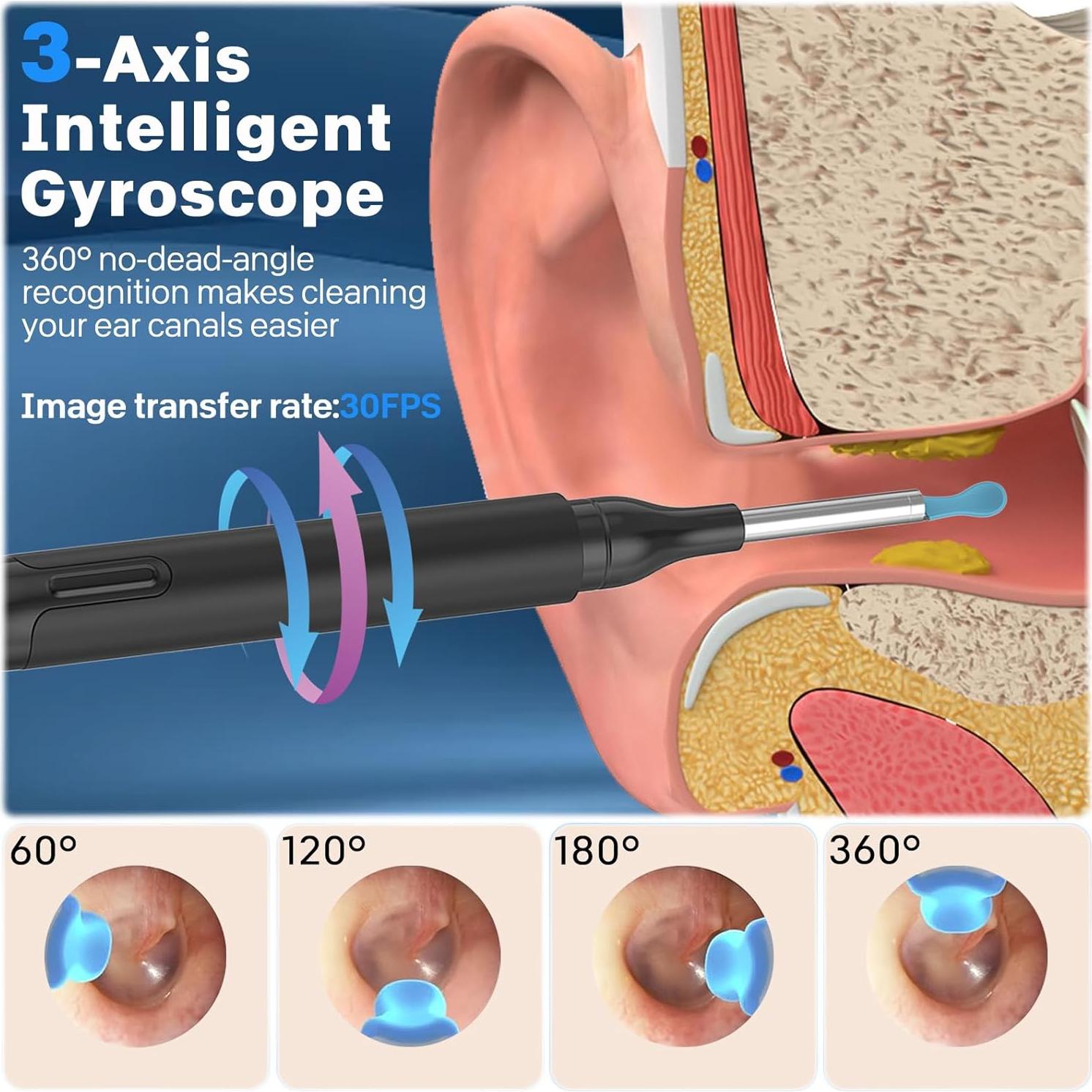 Kit Eliminación Cera de Oído Pobugy con Cámara 1080P y Luz