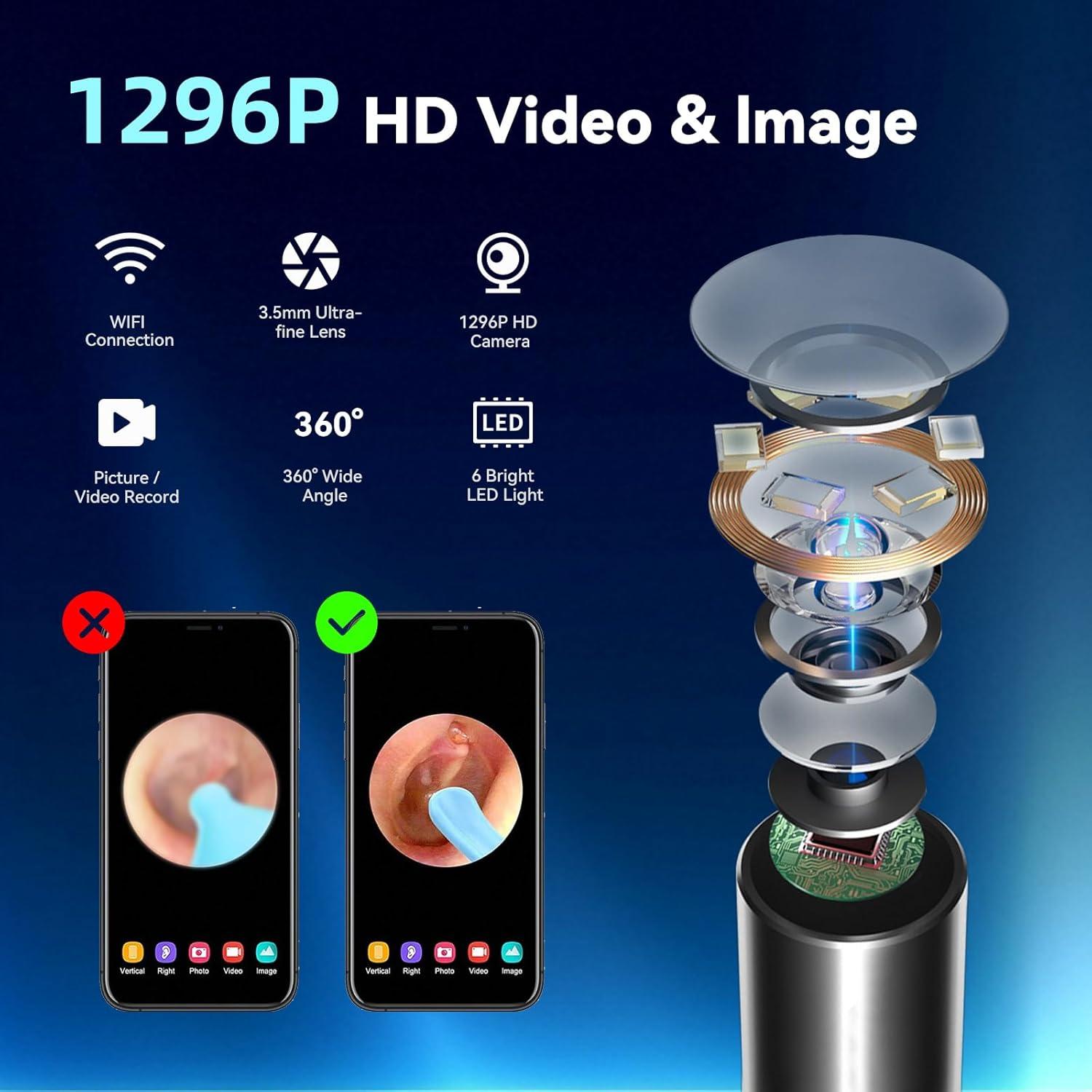 Limpiador de Oídos Fubangneer con Cámara HD y 6 LED