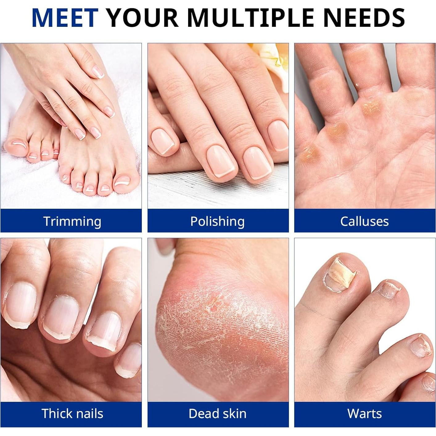 AIRSEE Professional Manicure Pedicure Kit,Cordless 6 in 1 Electric Nail File for feet,5 Speed Rechargeable Pedicure Tools for Thick Nail Toenail Cuticle, Hand Feet Trimmer Buffer for Women Men,White