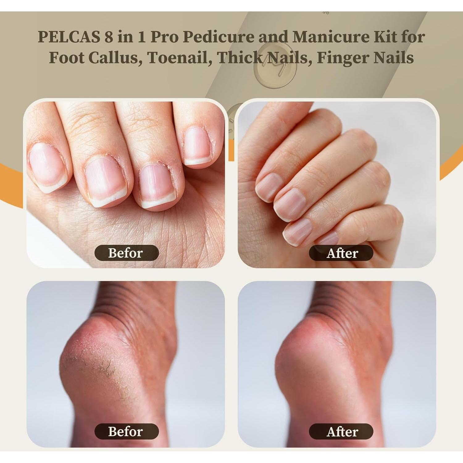 Taladro de Uñas Inalámbrico PELCAS 8 en 1 con Luz LED