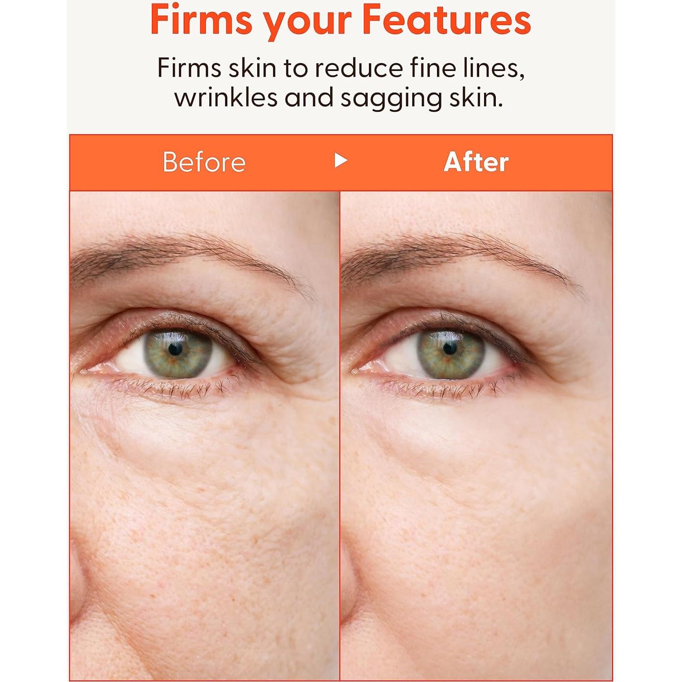 Emulsión Facial de Colágeno Marino It'S SKIN 150 ml