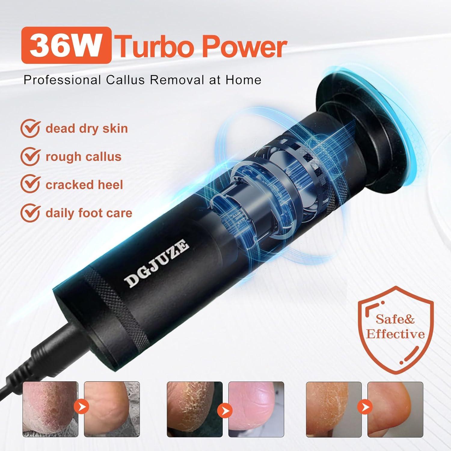 Removedor de Callos Eléctrico PowerPro 36W 1200RPM Negro