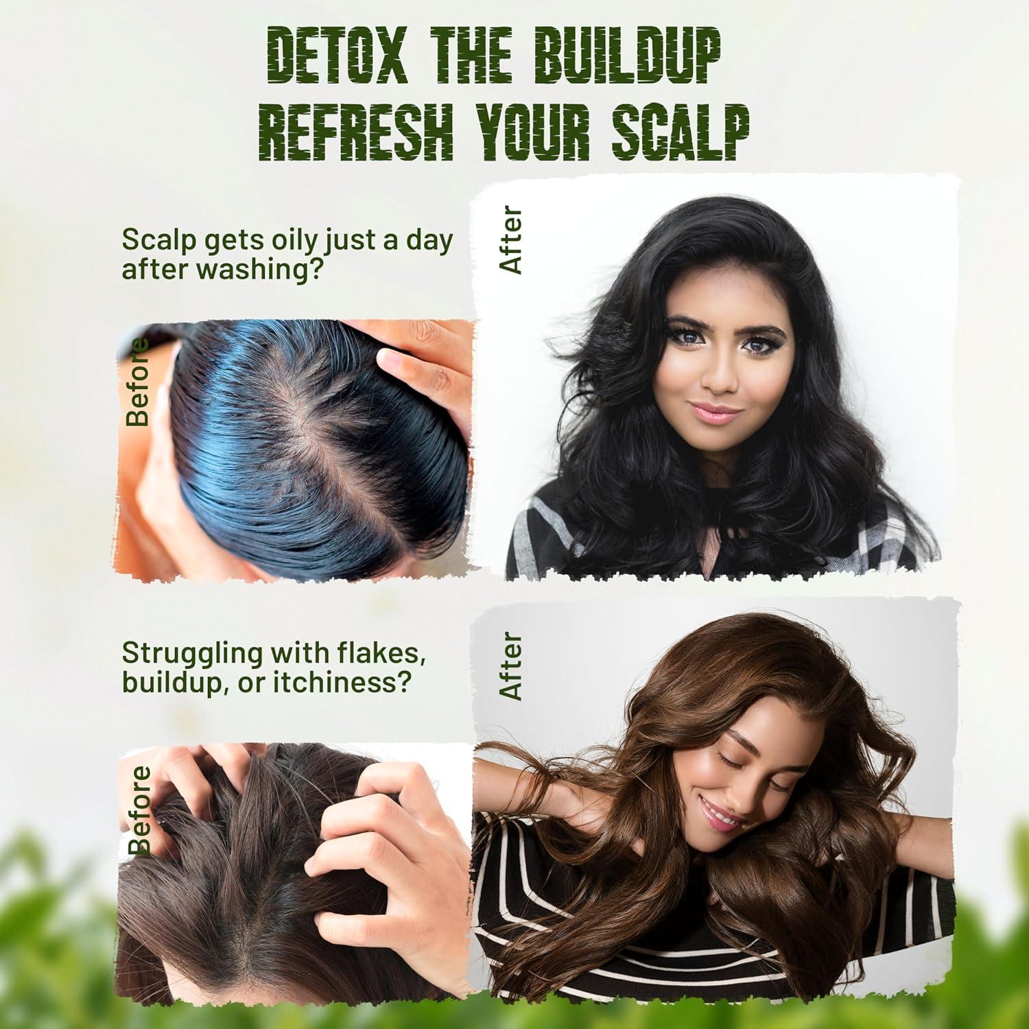 Champú Sólido Herbishh Tea Tree & Mint 100g - Cabello Graso