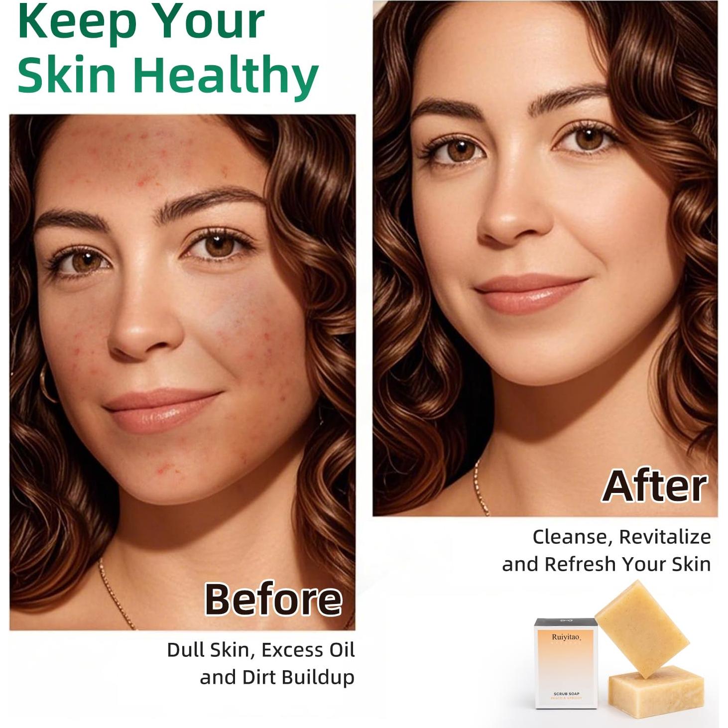 Jabón Ácido Kójico Ruiyitao 102g Hidratante y Aclarador