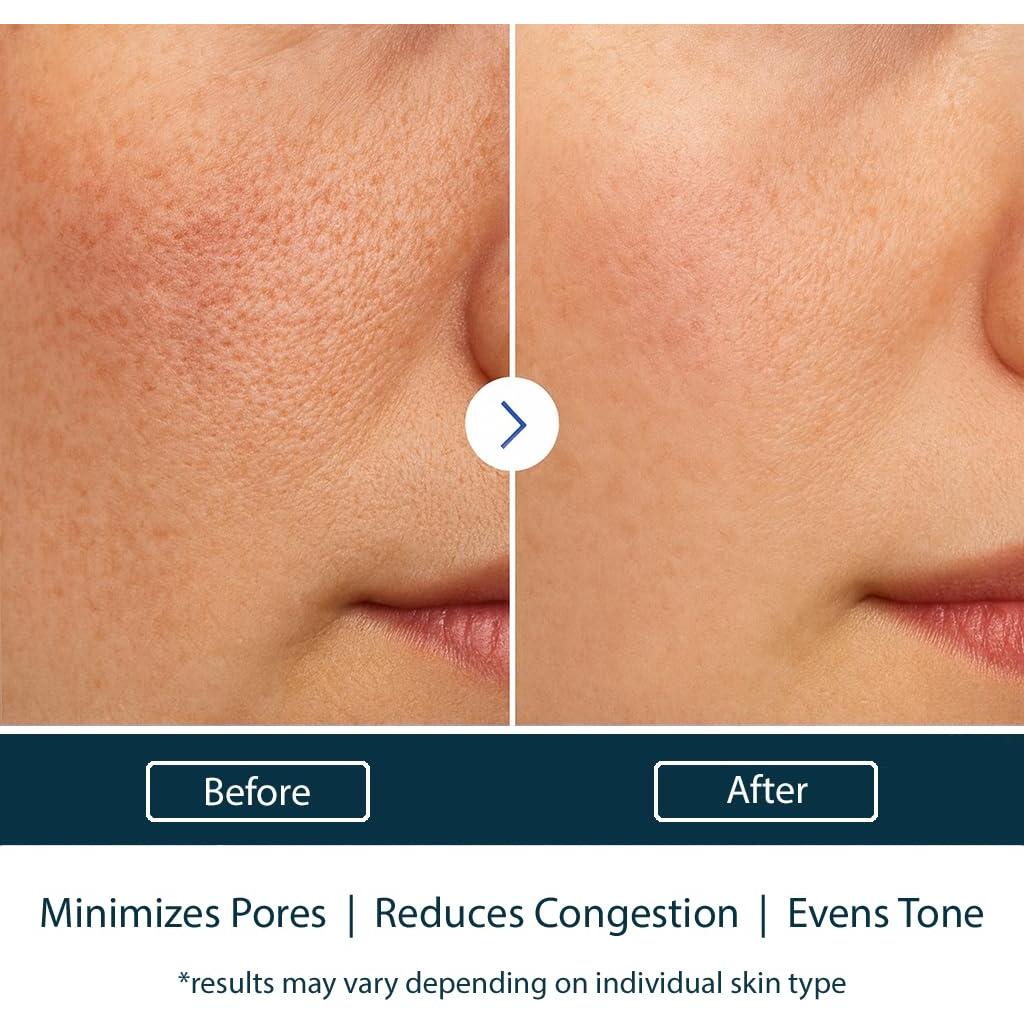 Limpiador Exfoliante Facial NAELI AHA/BHA 10% Ácido Glicólico 113.4g