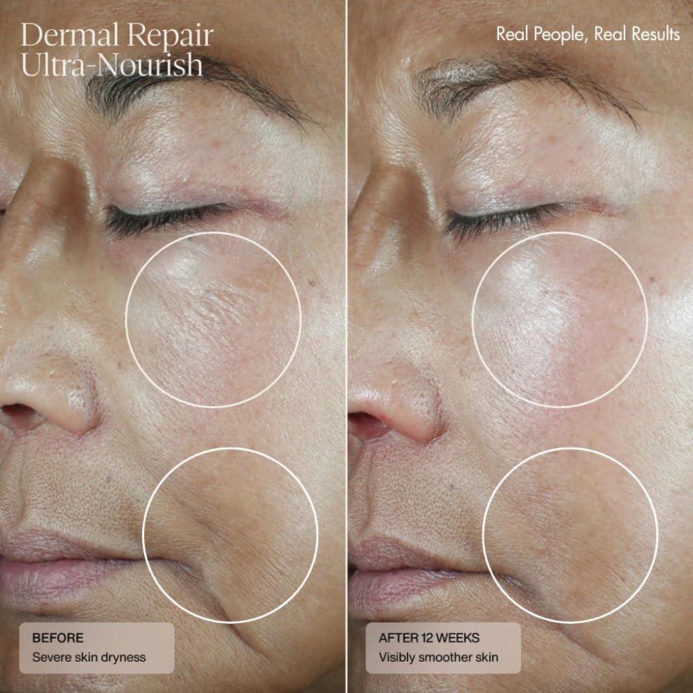 Senté Tratamiento Dermal Ultra-Nutrición 50 ml para Piel Seca