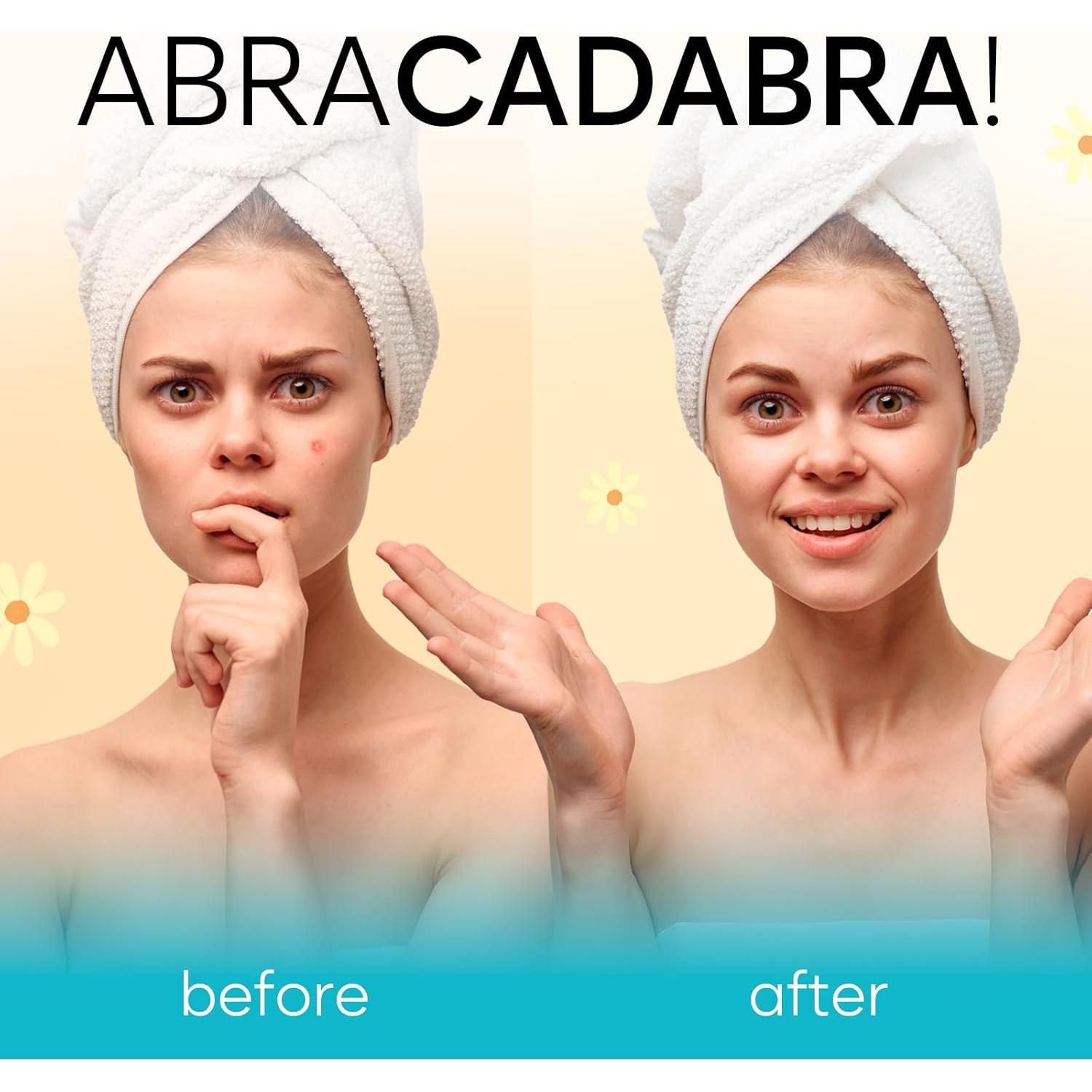 Parche Hidrocoloide para Espinillas Bloomora - 128 Piezas