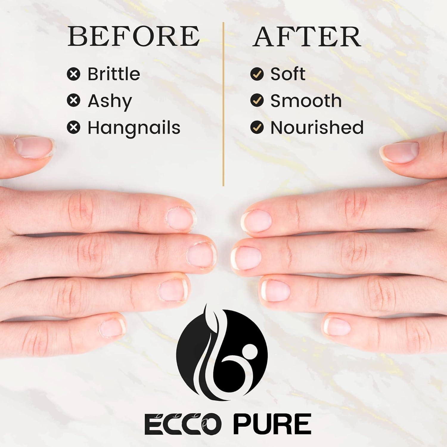 Cuticle Oil Foot Care – Nourishes & Protects Nails and Cuticles – Supports Healthy Toenails, Strength & Appearance – Essential Daily Treatment