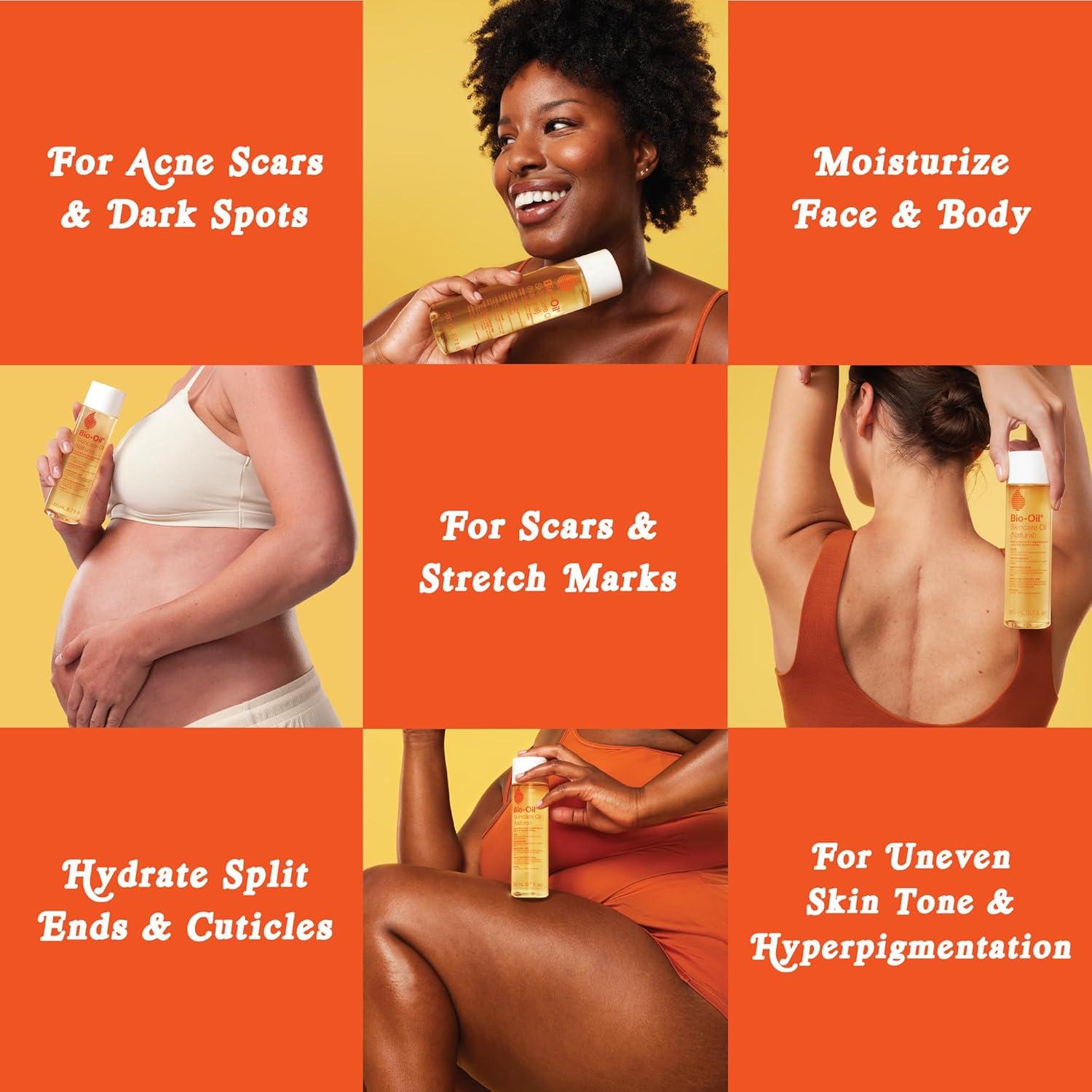 Bio-Oil Aceite Natural 24.1 ml x 3 - Hidratante Piel y Cicatrices
