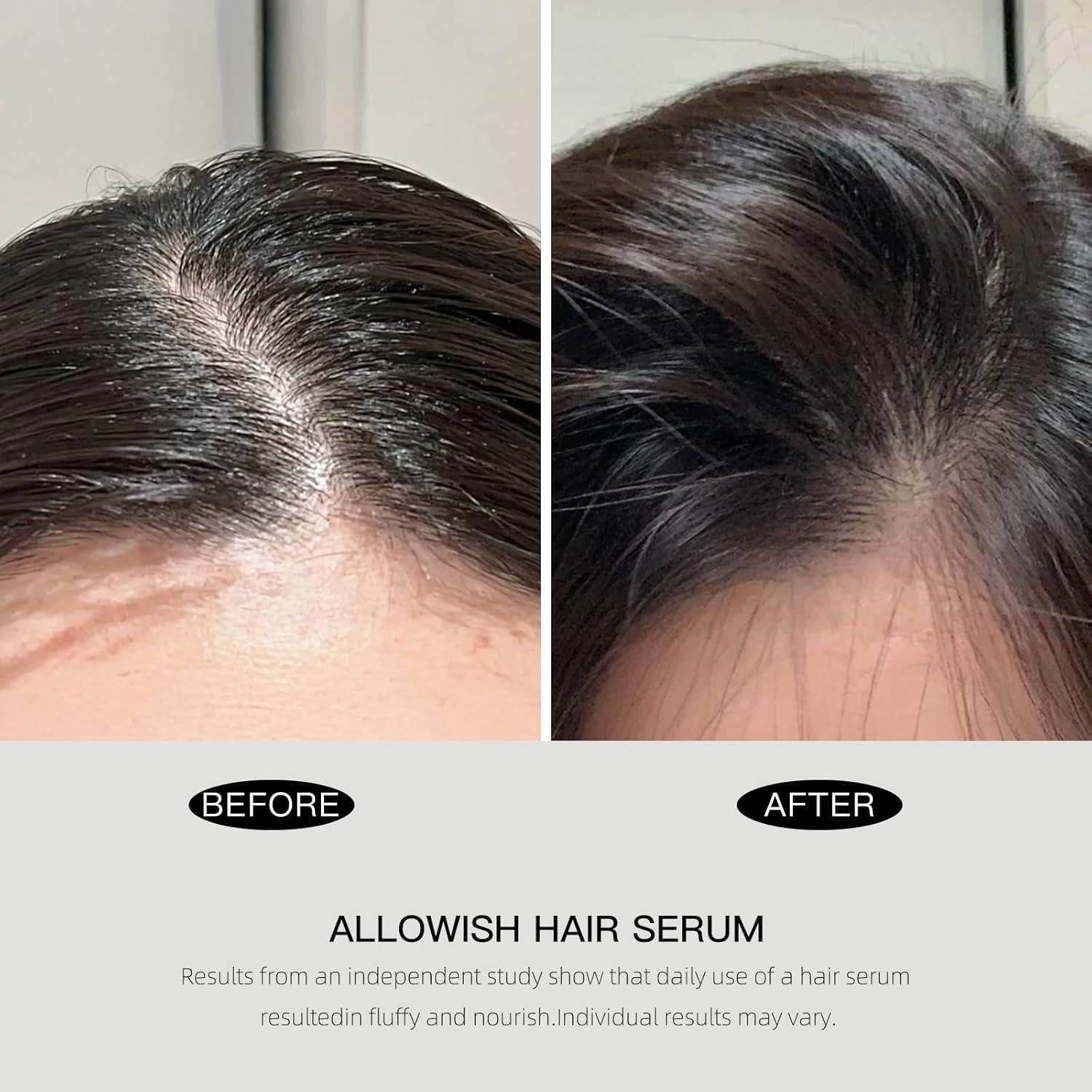 Suero Capilar Allowish 95 ml - Tratamiento Nutritivo para Cuero Cabelludo