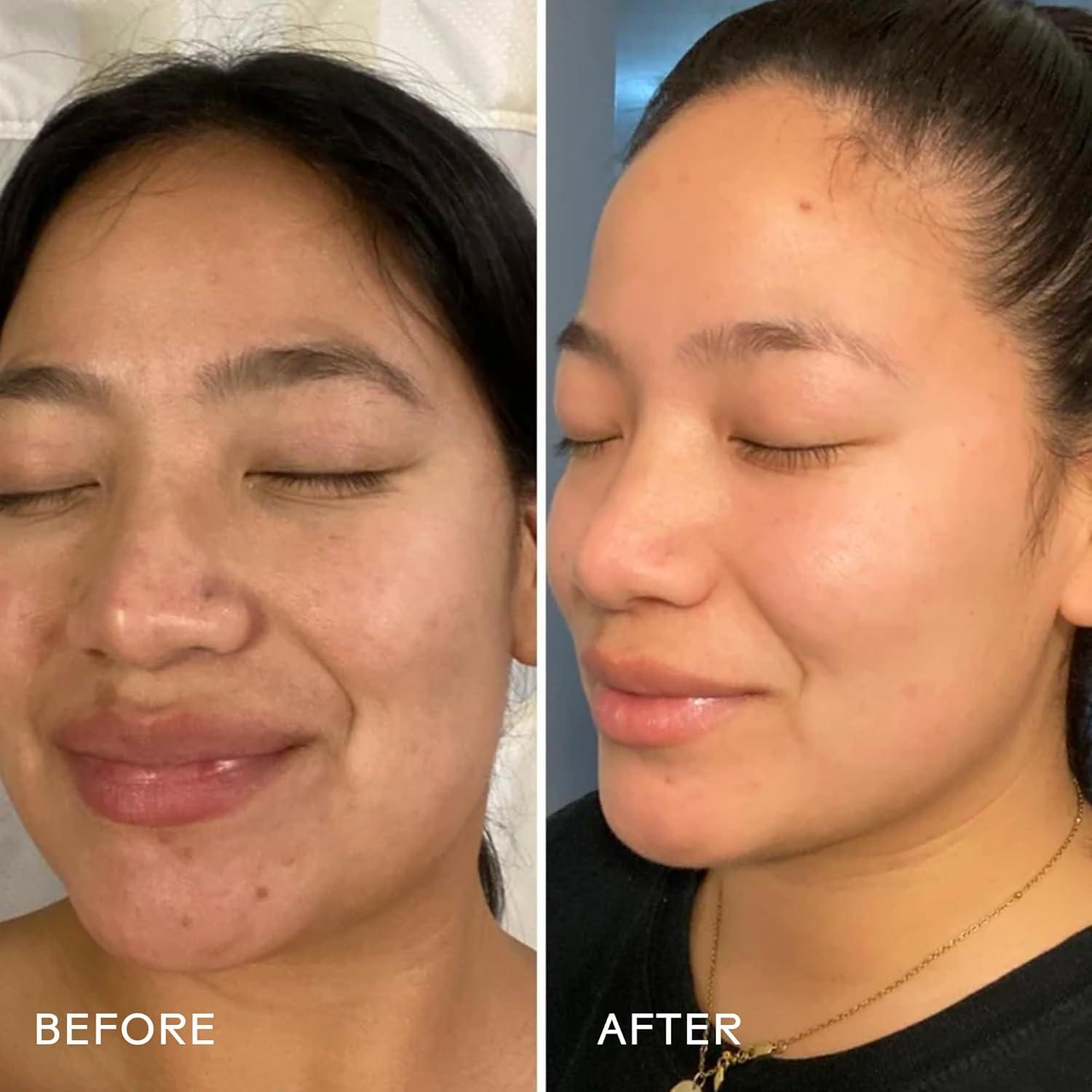 Crema Rejuvenecedora Three Ships Bio-Retinol 50 g - Hidratante