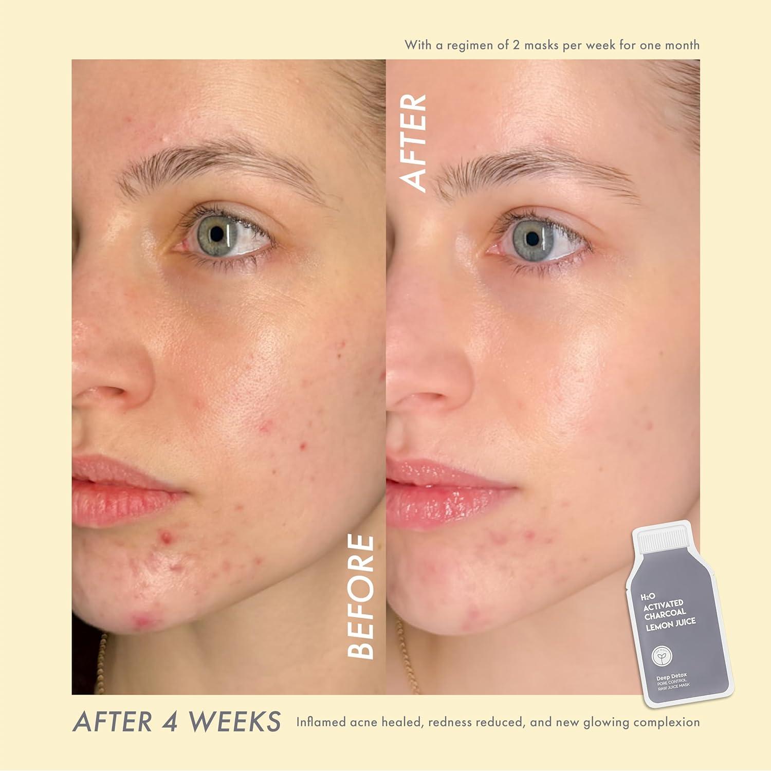 Máscara Facial Detox Profundo ESW - Carbón Activado y Limón