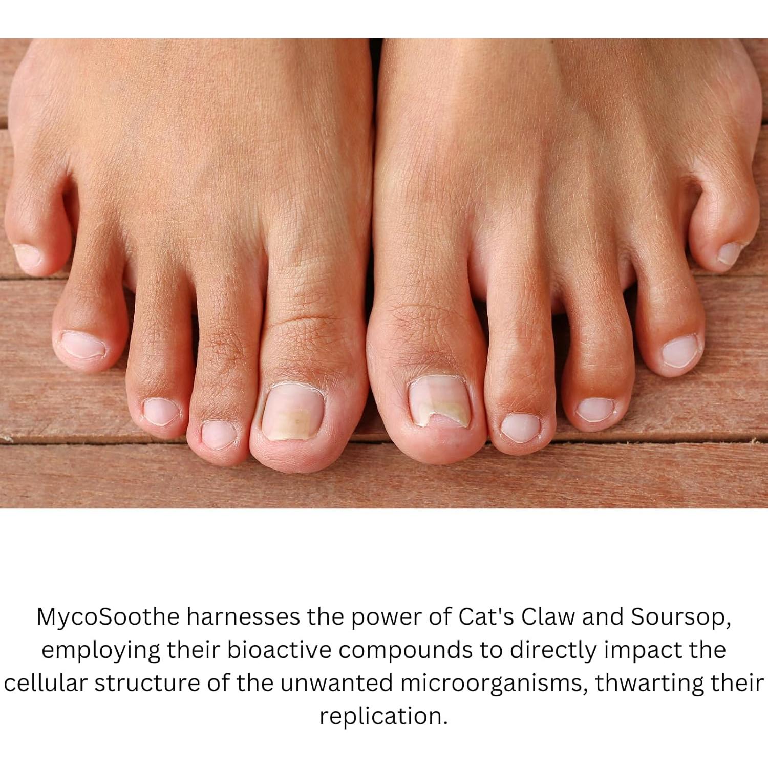 Suplemento Antioxidante MycoSoothe - 60 Cápsulas para Uñas y Inmunidad