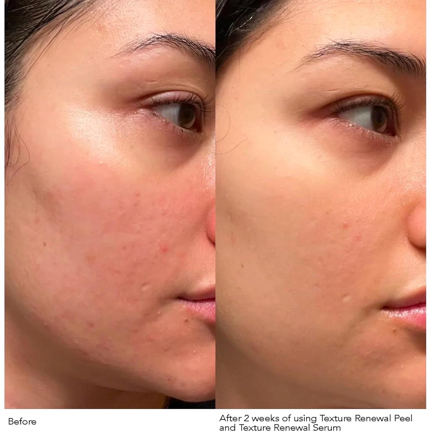 Suero Antienvejecimiento Dr. Dennis Gross 28.35 g - Textura Suave