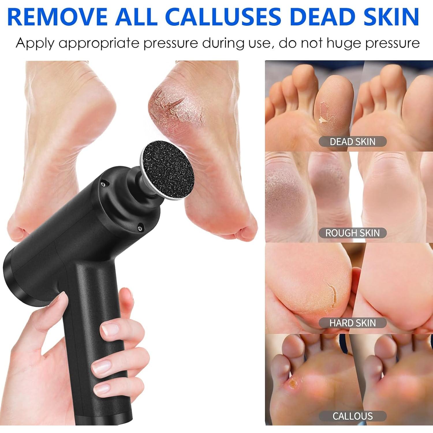 Removedor de Callos Eléctrico FCR-3 Negro 4500rpm 10 Velocidades