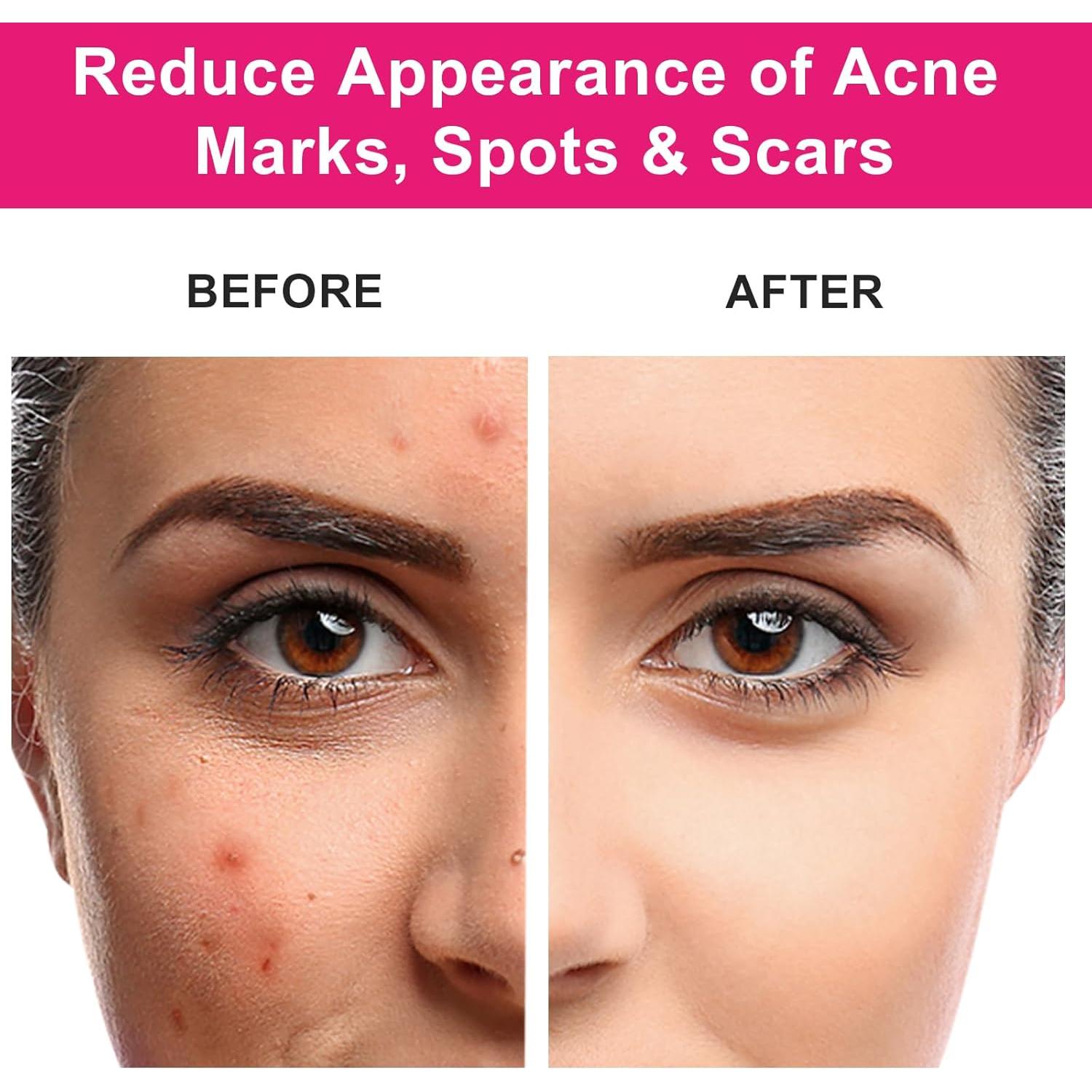 Aceite de Rosa Mosqueta Orgánico MMPANG 30ml Antienvejecimiento