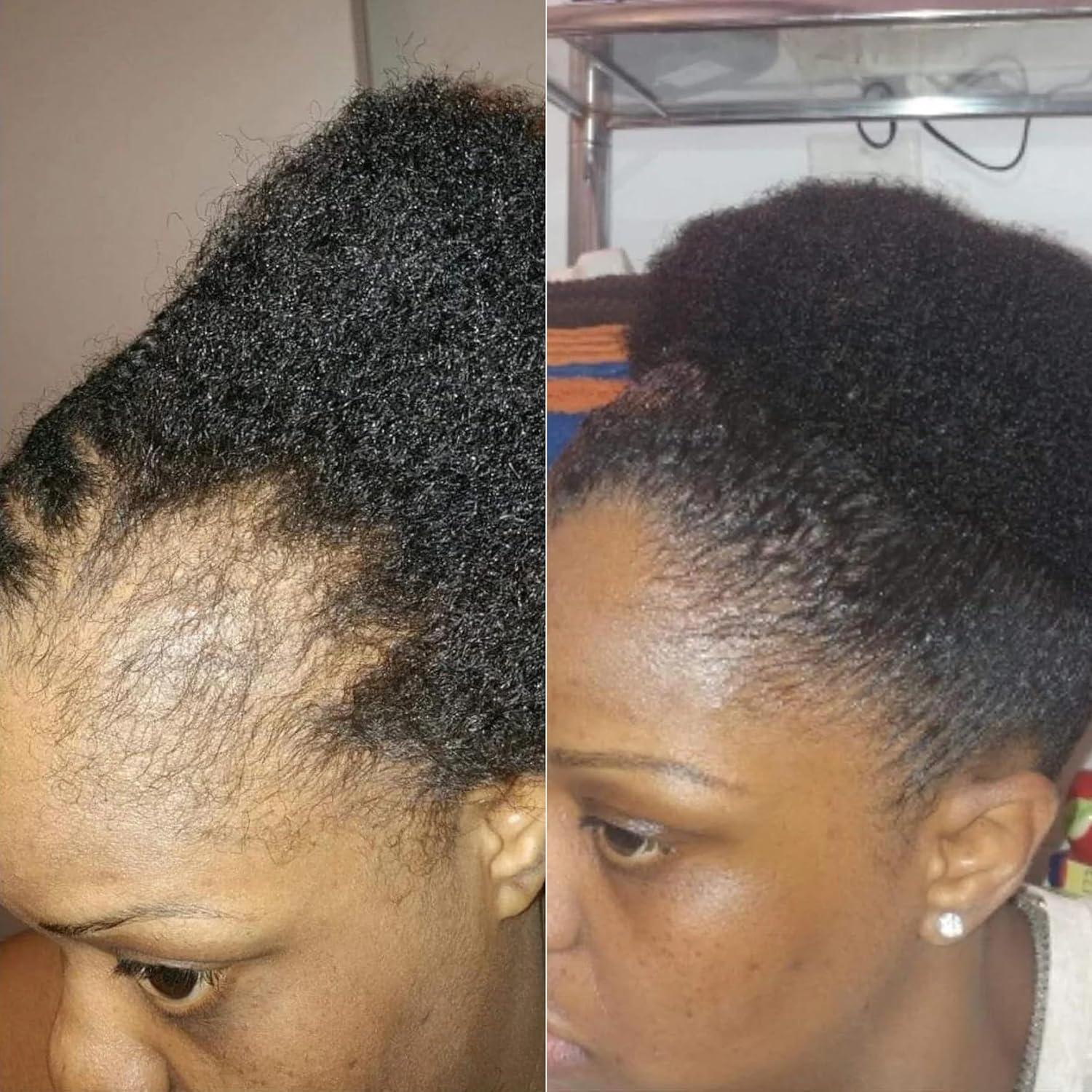 Sérum Hidratante Peppermint Blast 113.4 g - Crecimiento Cabello