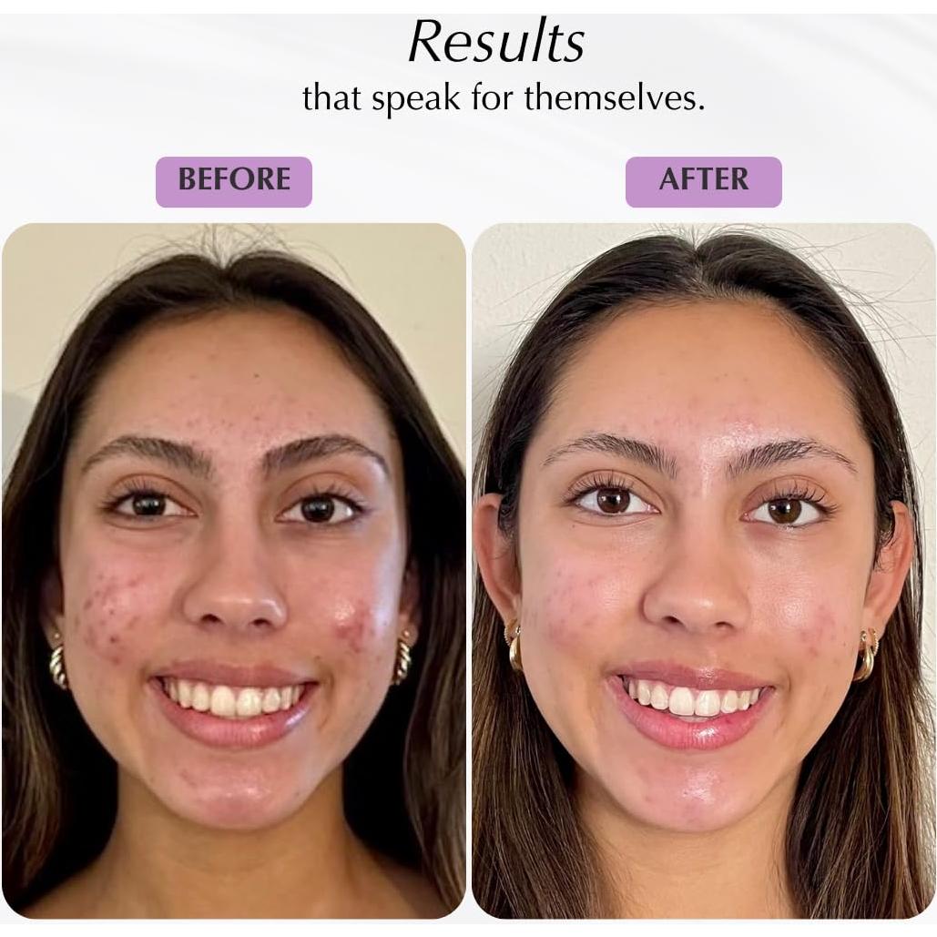 Máscara Facial SHIMMER CHEF Puré de Papaya 70.87 g