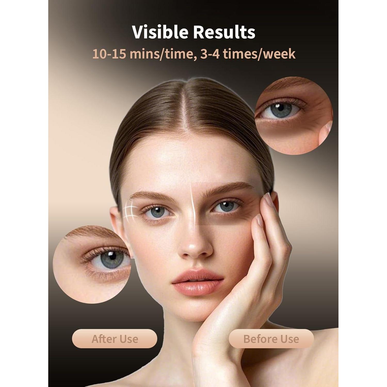 Máscara de Terapia de Luz Roja Lightinmax para Ojos - 5 Modos