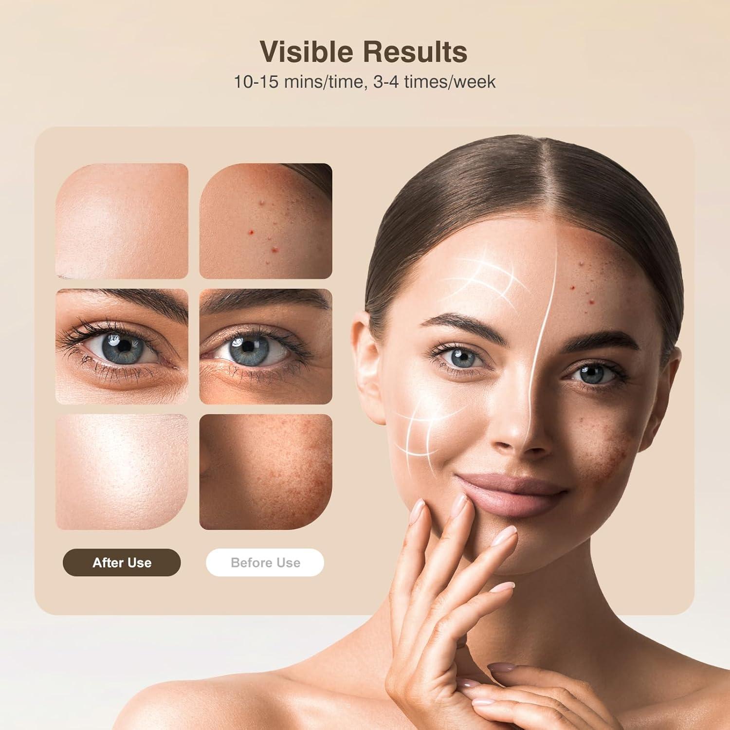 Máscara de Terapia de Luz Roja INTEO 4 Modos LED 850nm