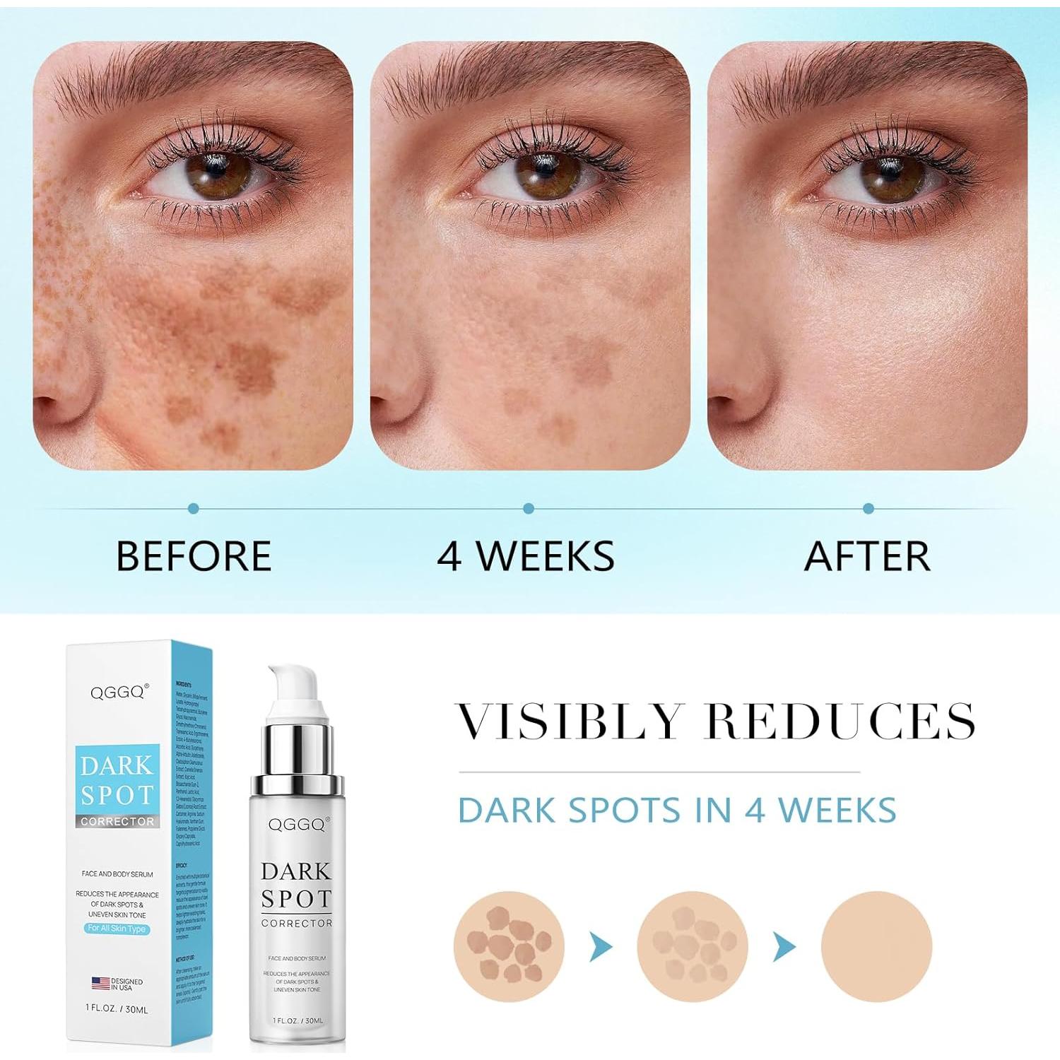 Suero Removedor de Manchas Oscuras QGGQ 30 ml - Niacinamida