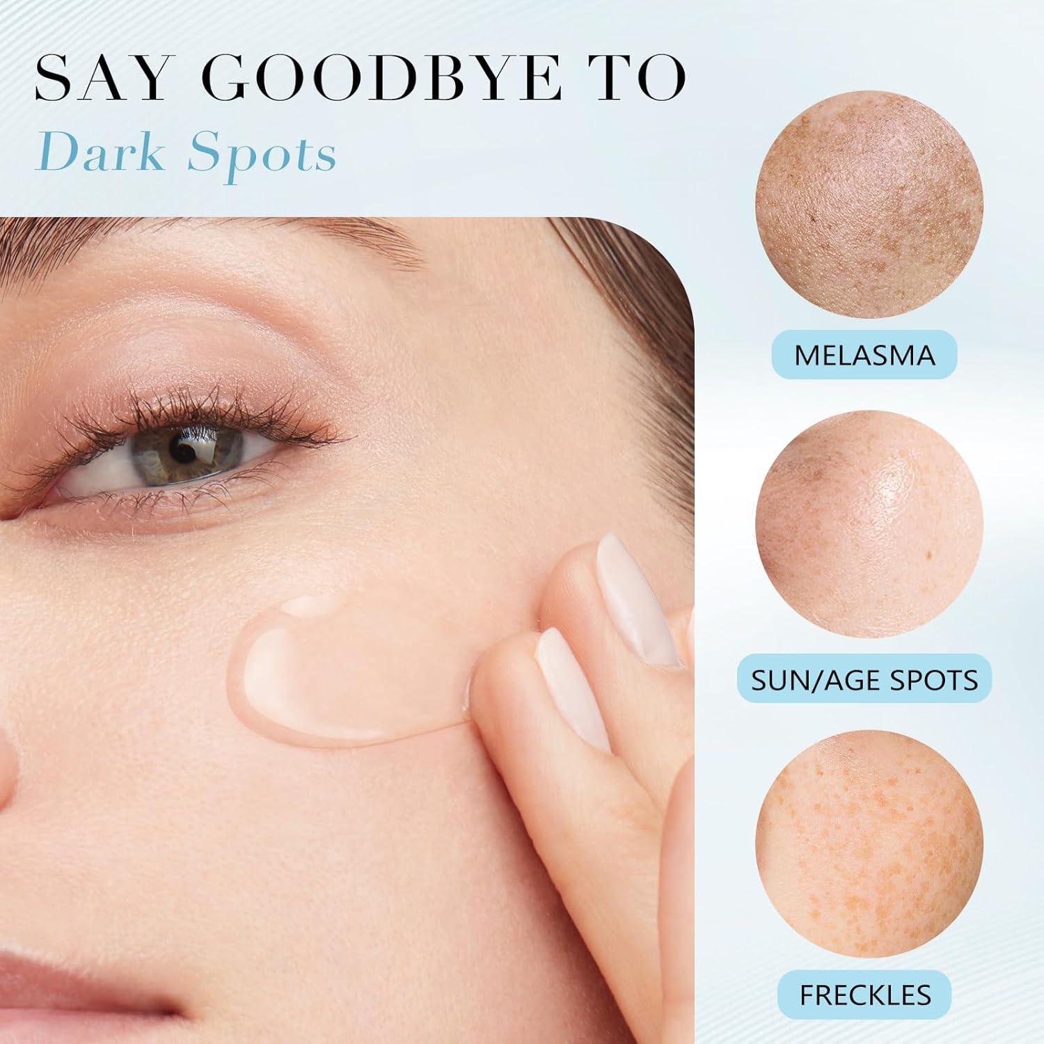 Suero Removedor de Manchas Oscuras QGGQ 30 ml - Niacinamida