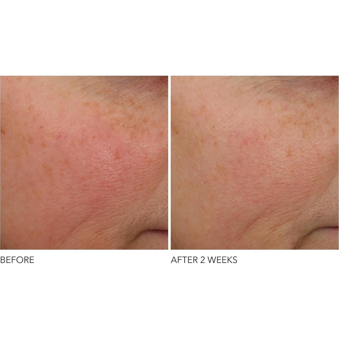 Tratamiento Nocturno Avanzado Dr Dennis Gross 28.35 g Retinol