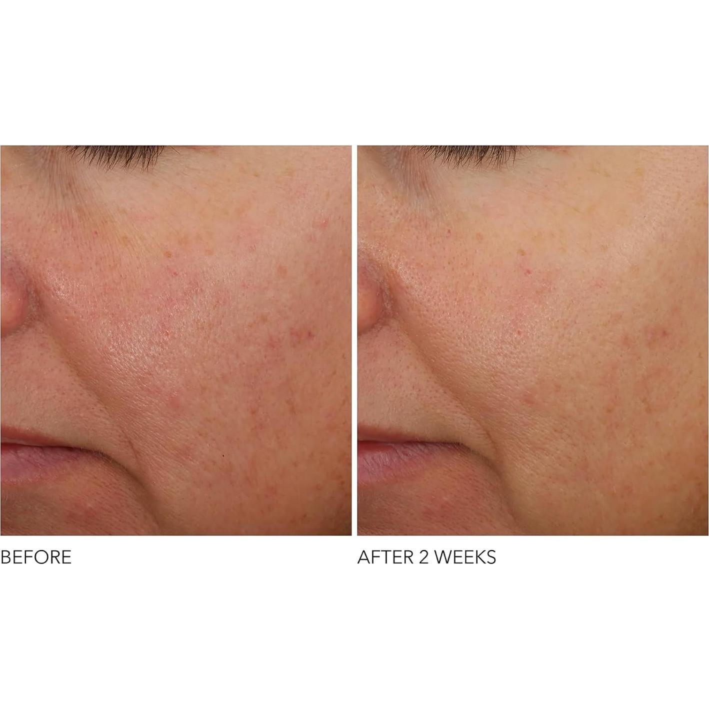 Tratamiento Nocturno Avanzado Dr Dennis Gross 28.35 g Retinol