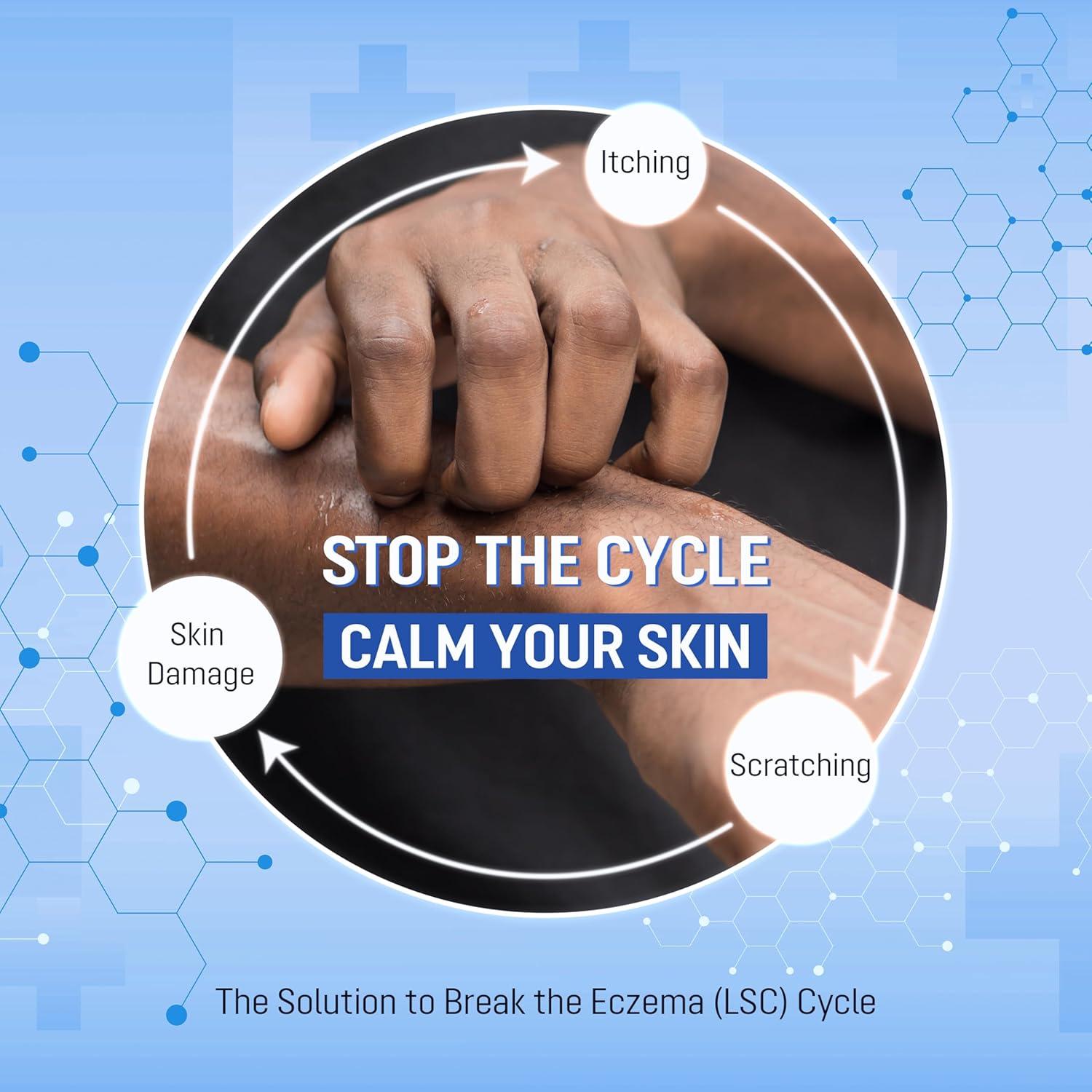 Crema Alivio Dermatitis Seborreica ABERA 30 ml - Peptizinc