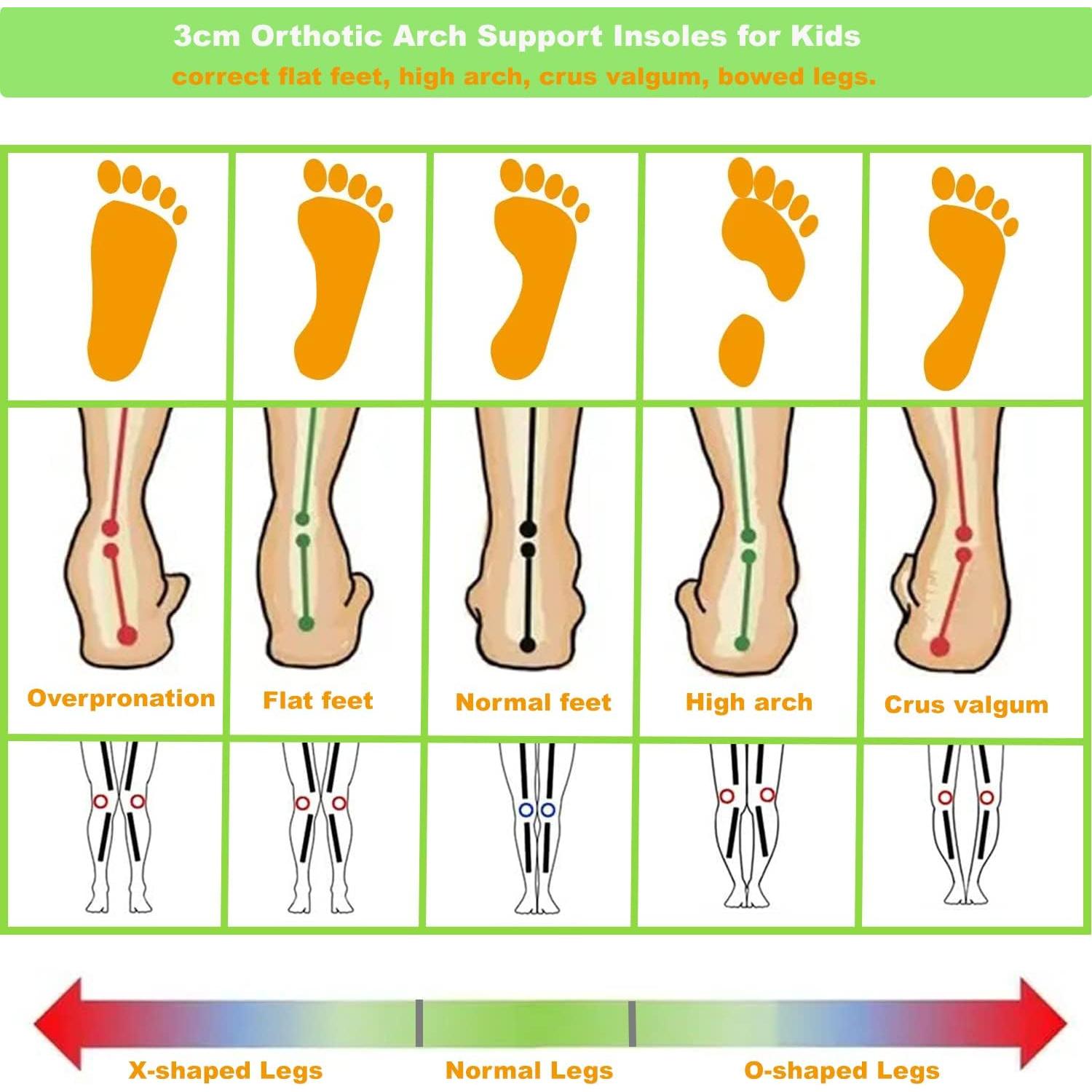 Plantillas ortopédicas Bellcon para niños, soporte arco, gel